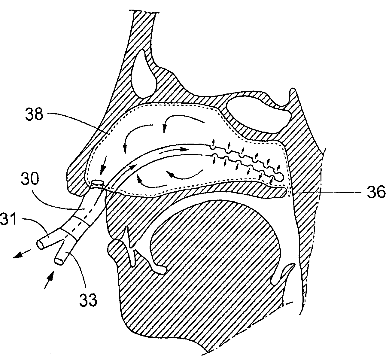 Cerebral temperature control