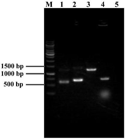 L-proline-4-hydroxylase and genetic engineering bacterium thereof, construction method and application thereof