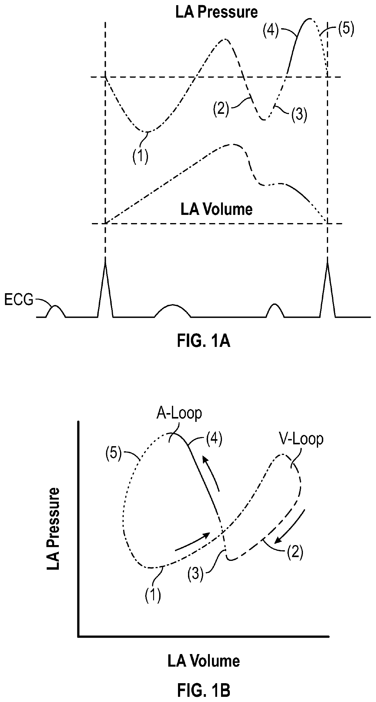 Intra-cardiac left atrial and dual support systems