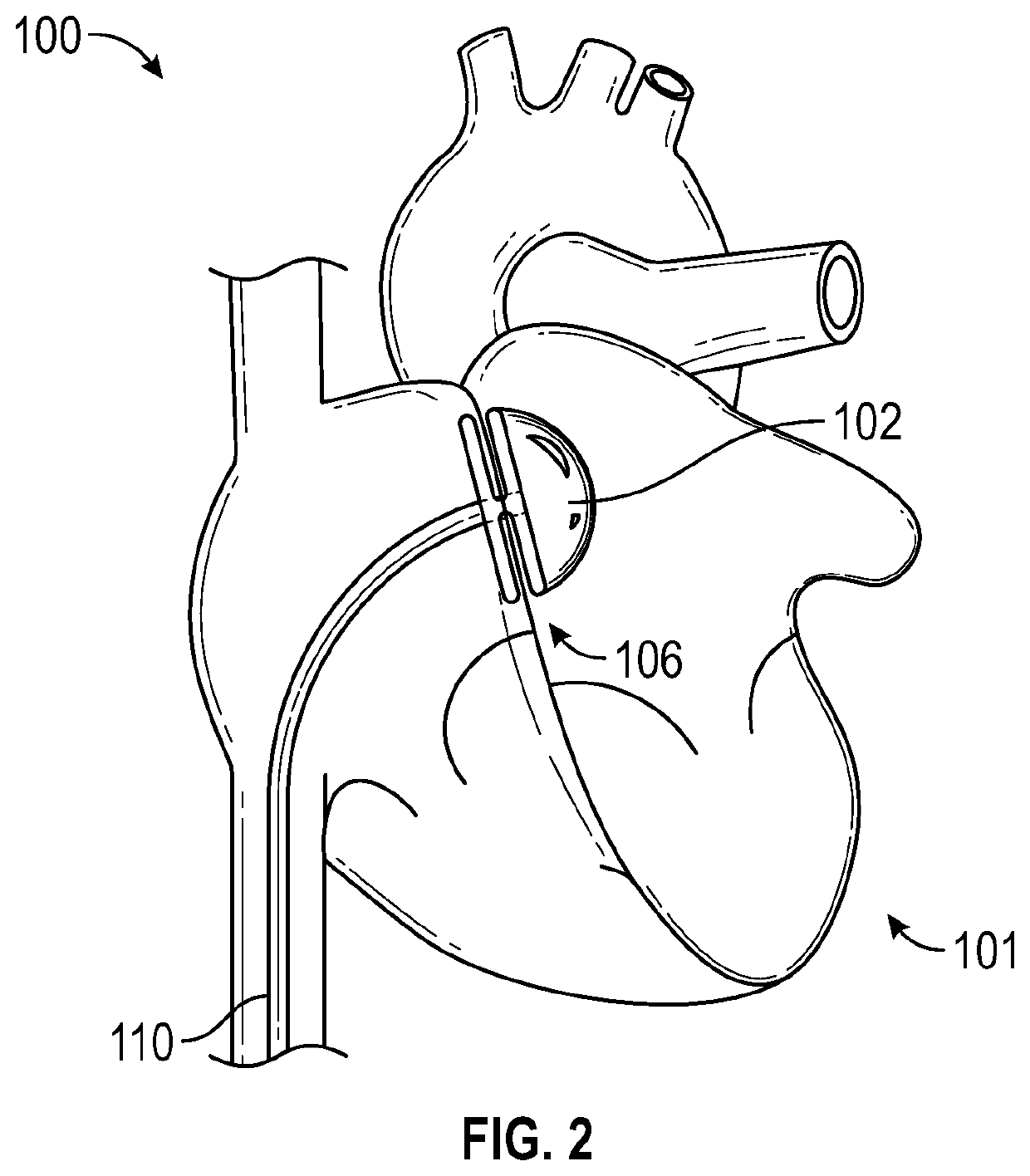 Intra-cardiac left atrial and dual support systems