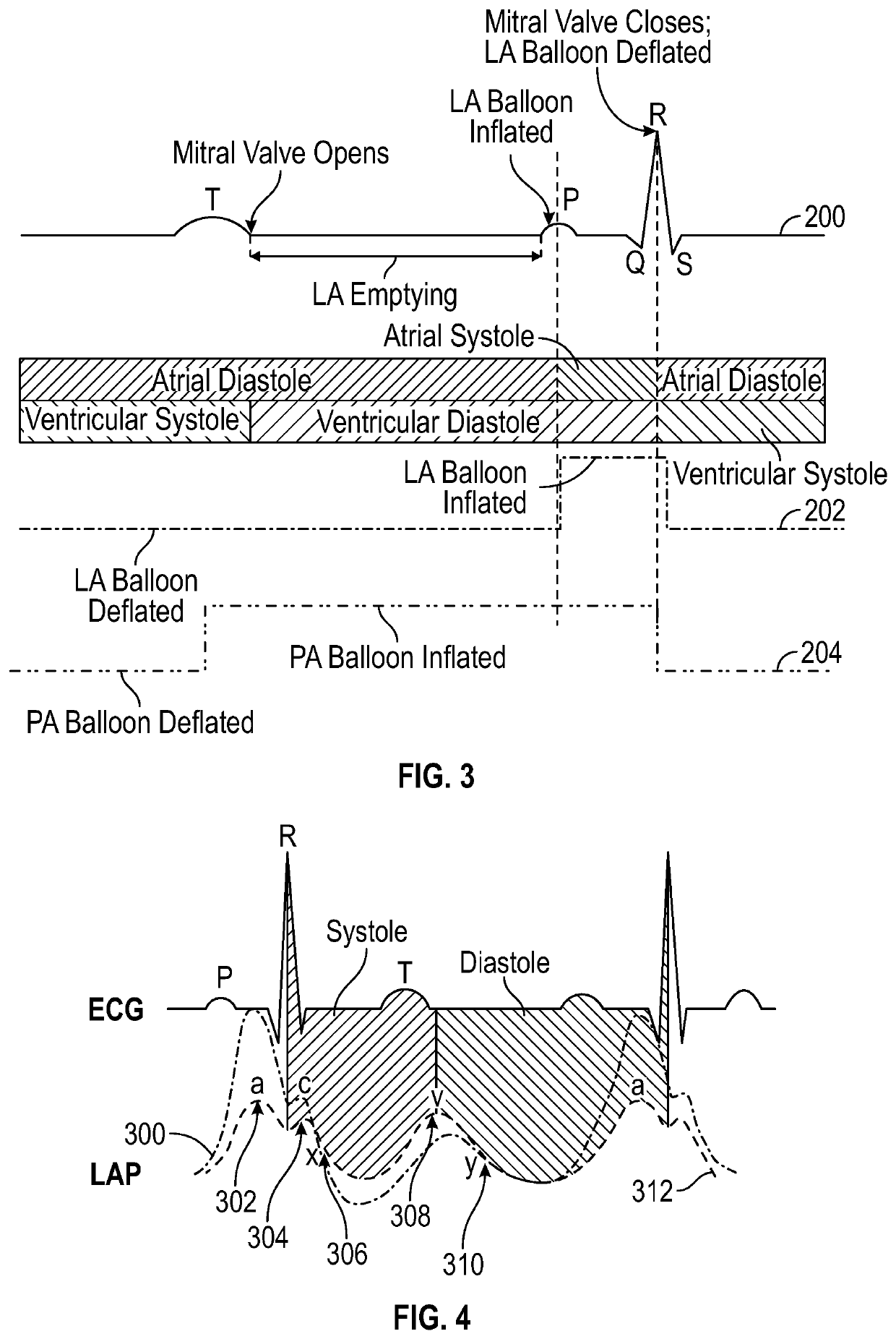 Intra-cardiac left atrial and dual support systems