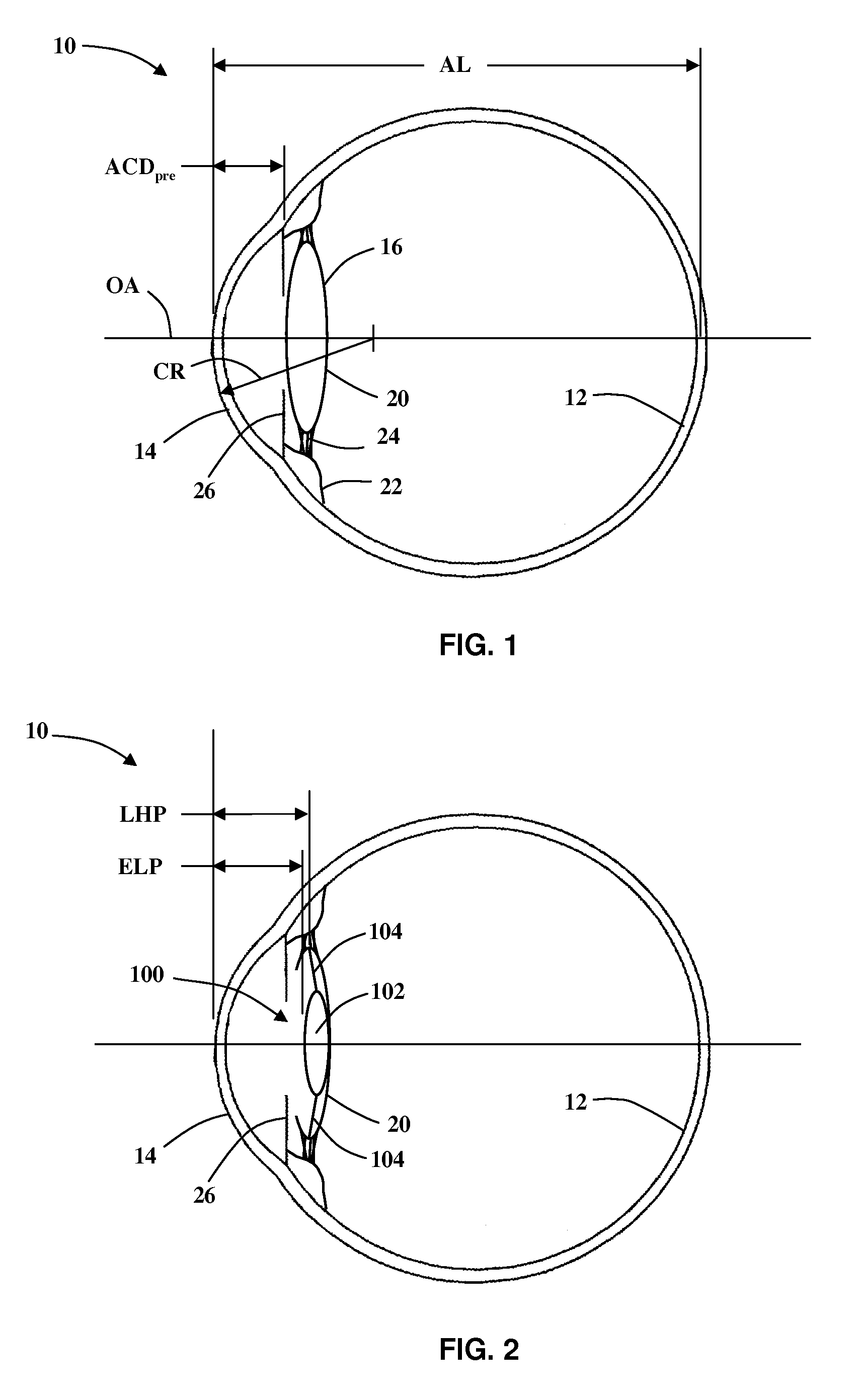 Systems and methods for determining intraocular lens power