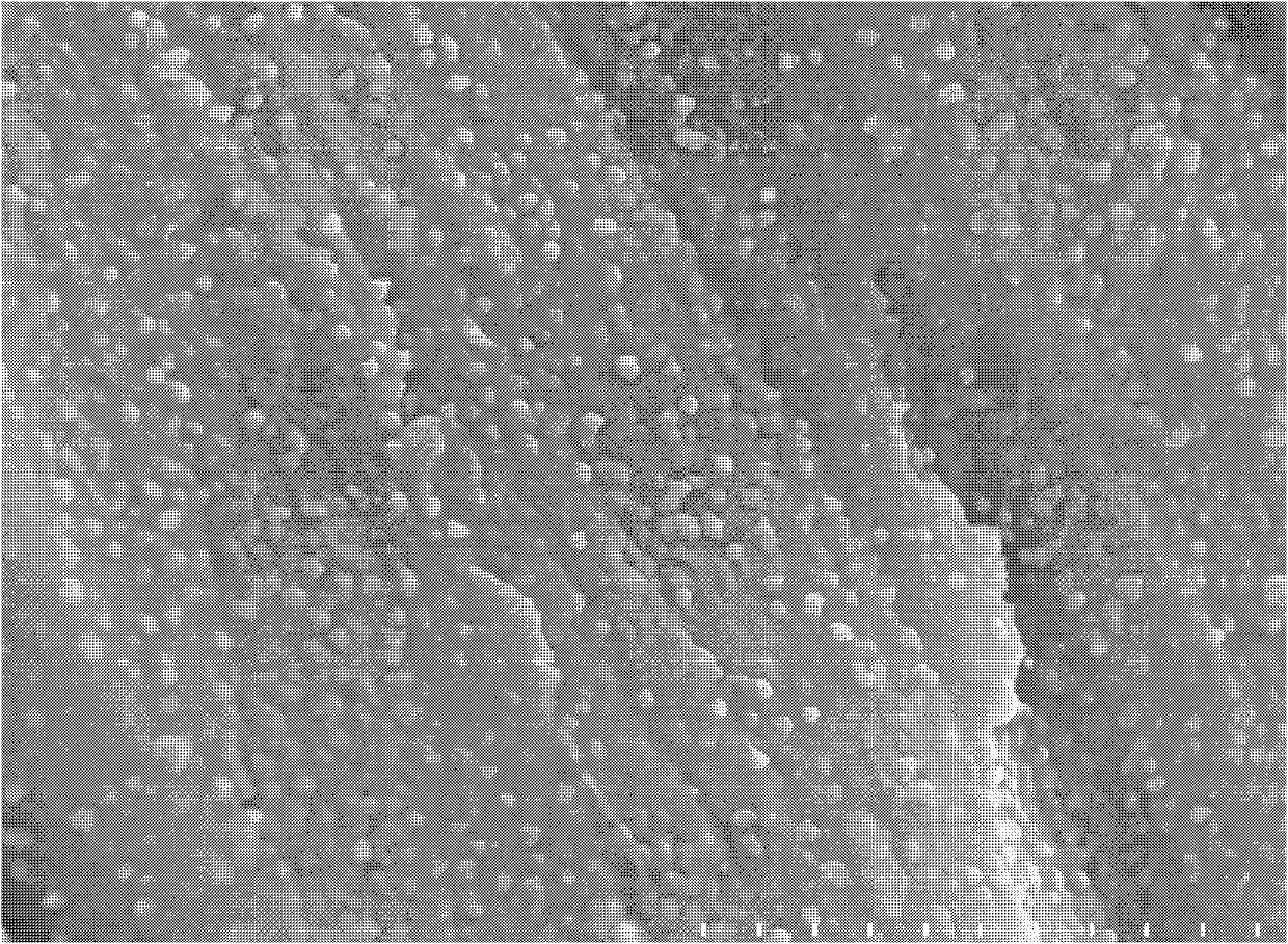 Medicinal silver-loaded metal bioactive coating as well as preparation method and application thereof