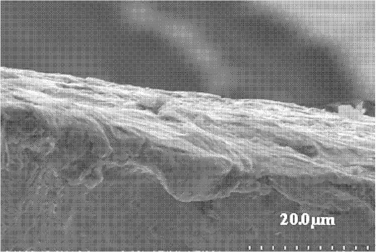 Medicinal silver-loaded metal bioactive coating as well as preparation method and application thereof