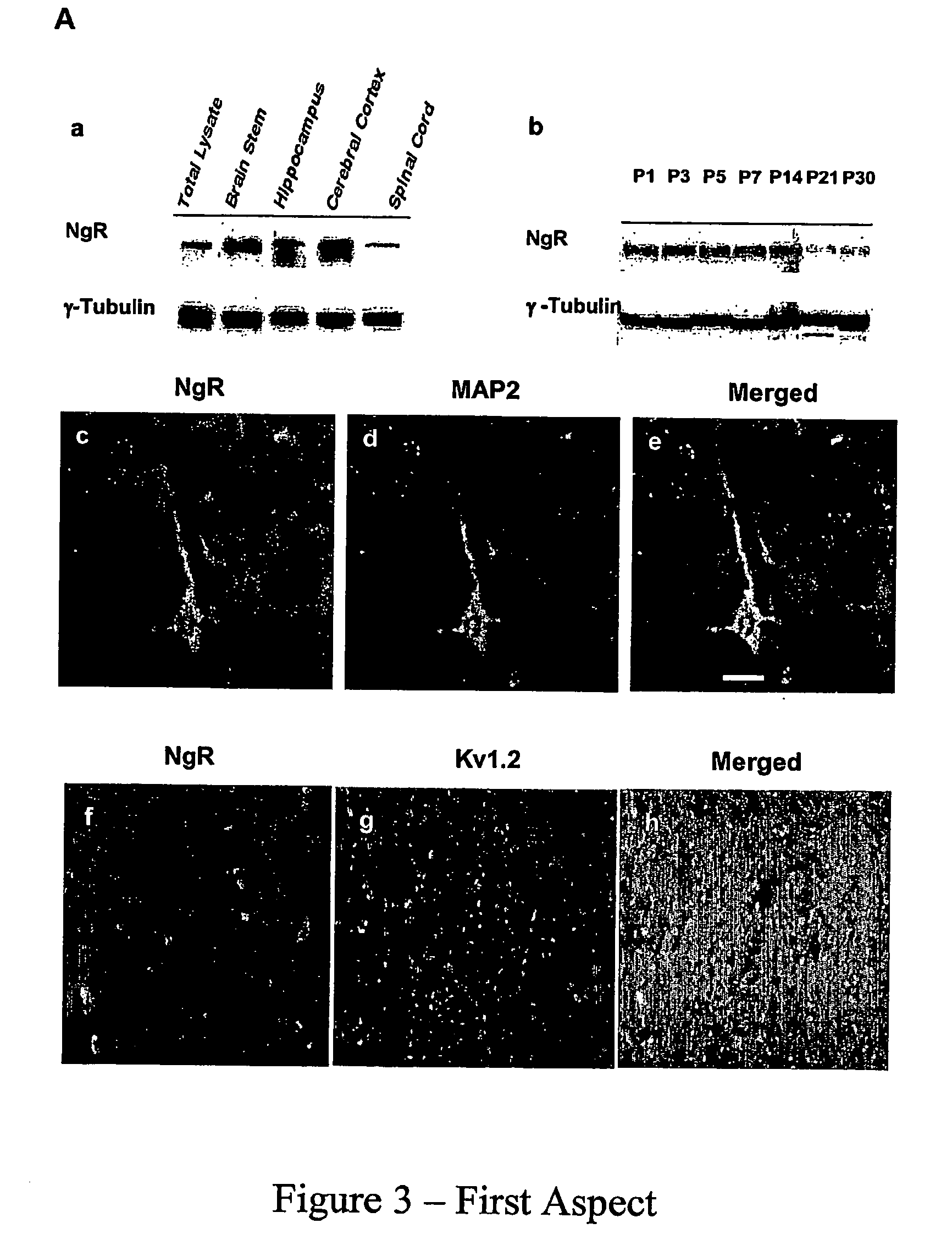 Nogo, caspr, f3 nb-3 useful in the treatment of injury and disease to the central nervous system