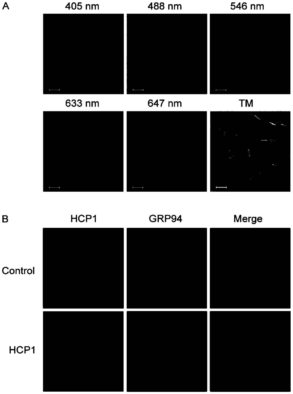 Application of 7-hydroxycoumarin pyrazoline derivatives in the preparation of grp94 inhibitors