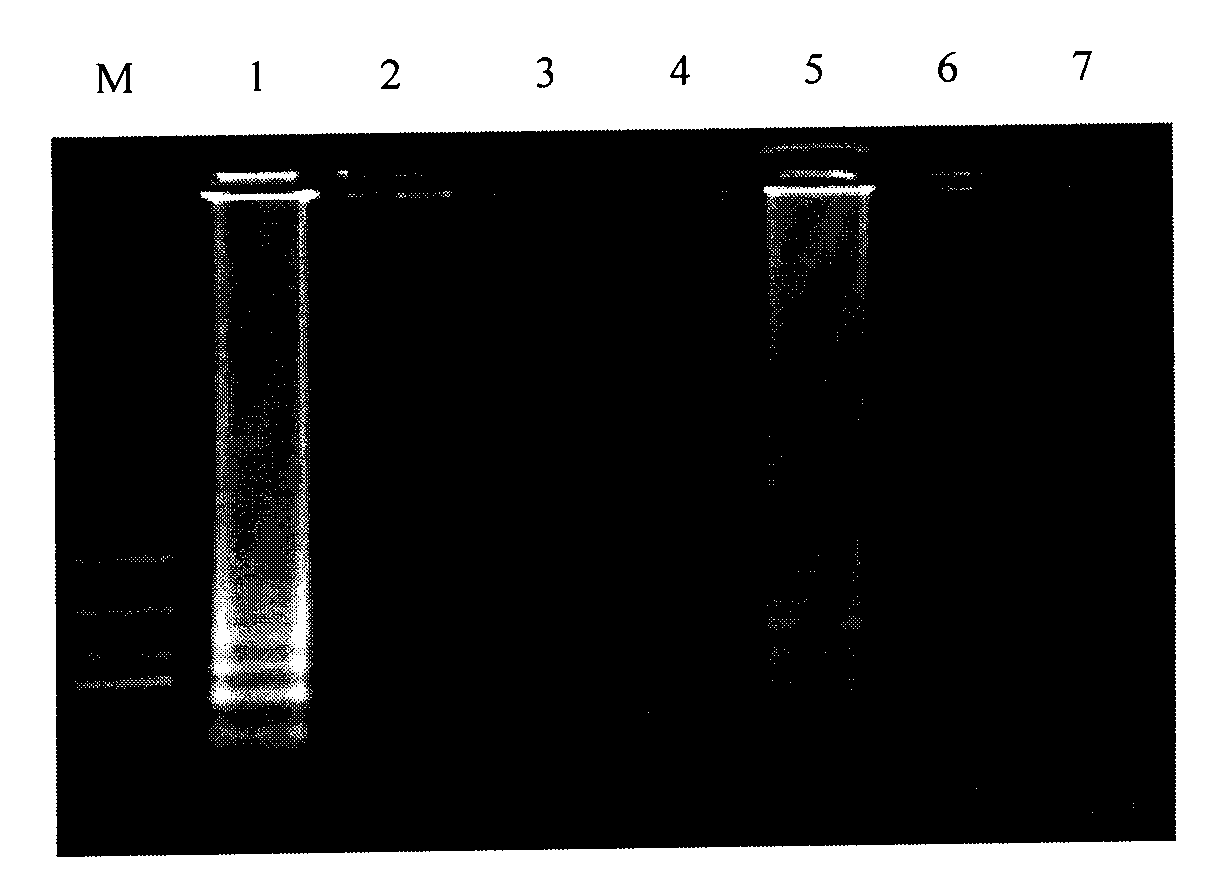 Kit for detecting echinococcus multilocularis pathogen from dog excrement