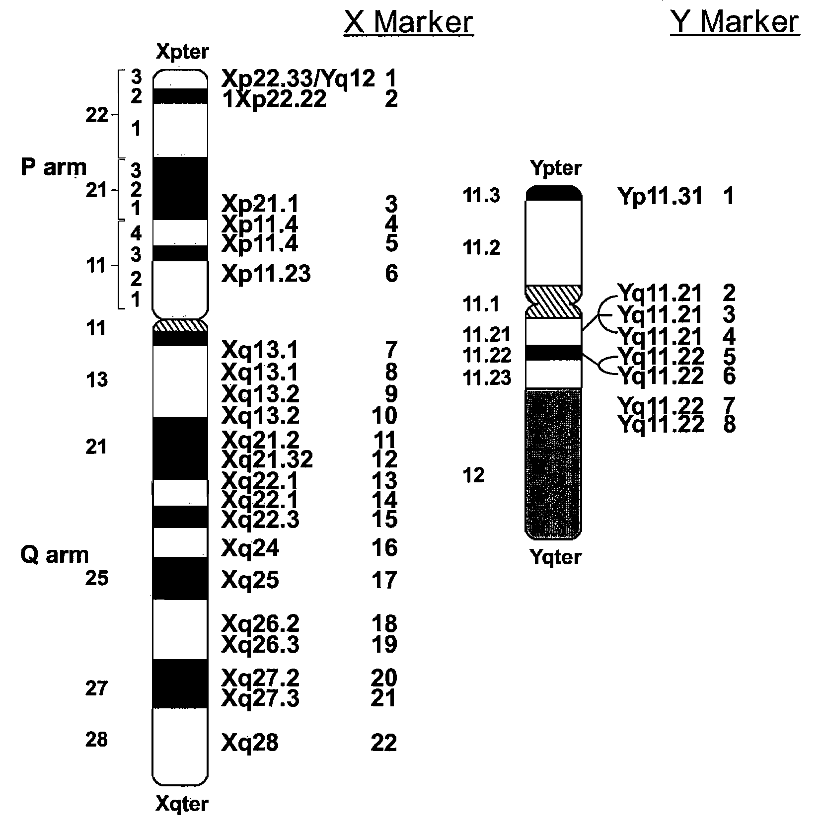 DNA Diagnostic screening for turner syndrome and sex chromosome disorders