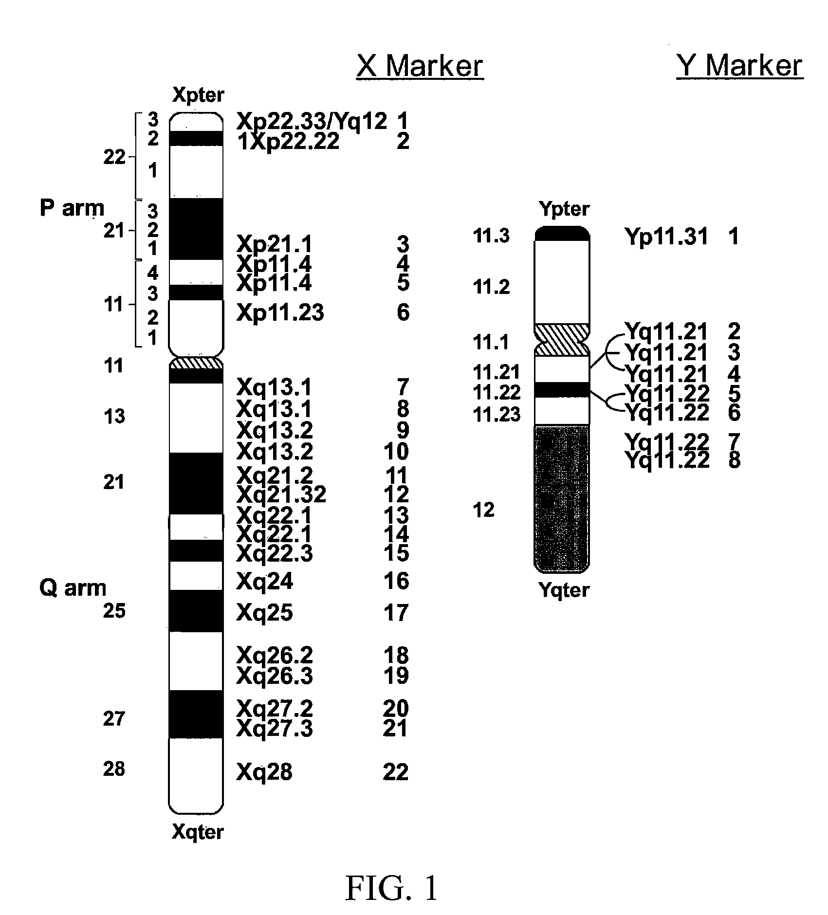 DNA Diagnostic screening for turner syndrome and sex chromosome disorders