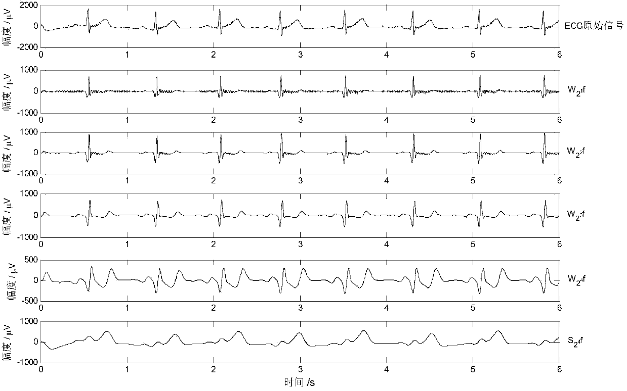 System and method for phase synchronization analysis of cardiopulmonary system