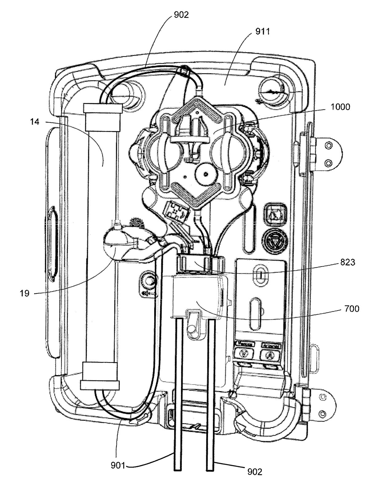 Hemodialysis system