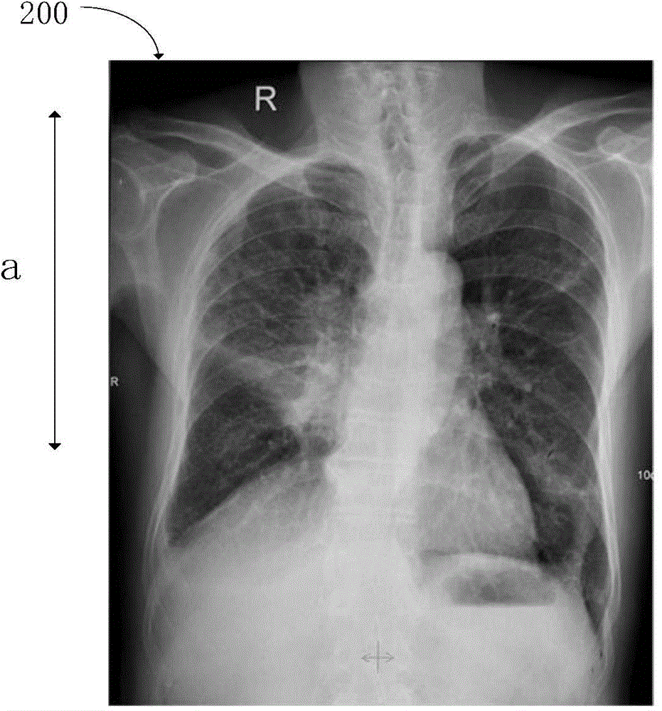 PET-CT scanning imaging method and related imaging method