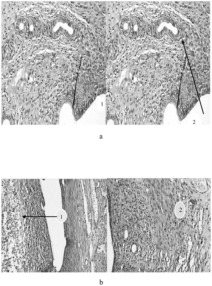 Medicament for treating gynecological belt syndrome and preparation method thereof