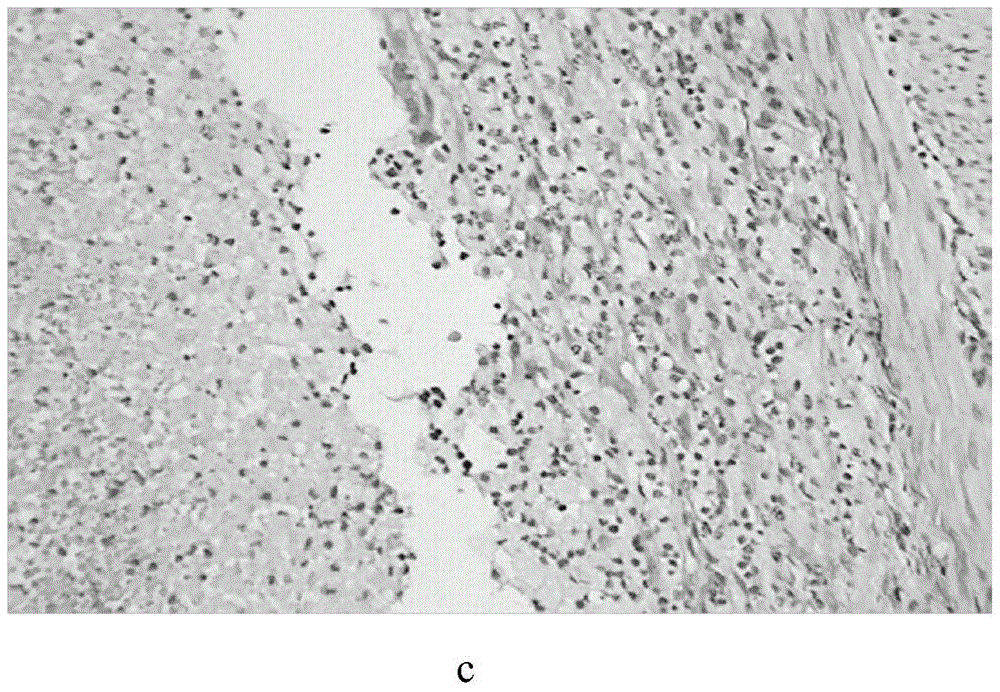 Medicament for treating gynecological belt syndrome and preparation method thereof