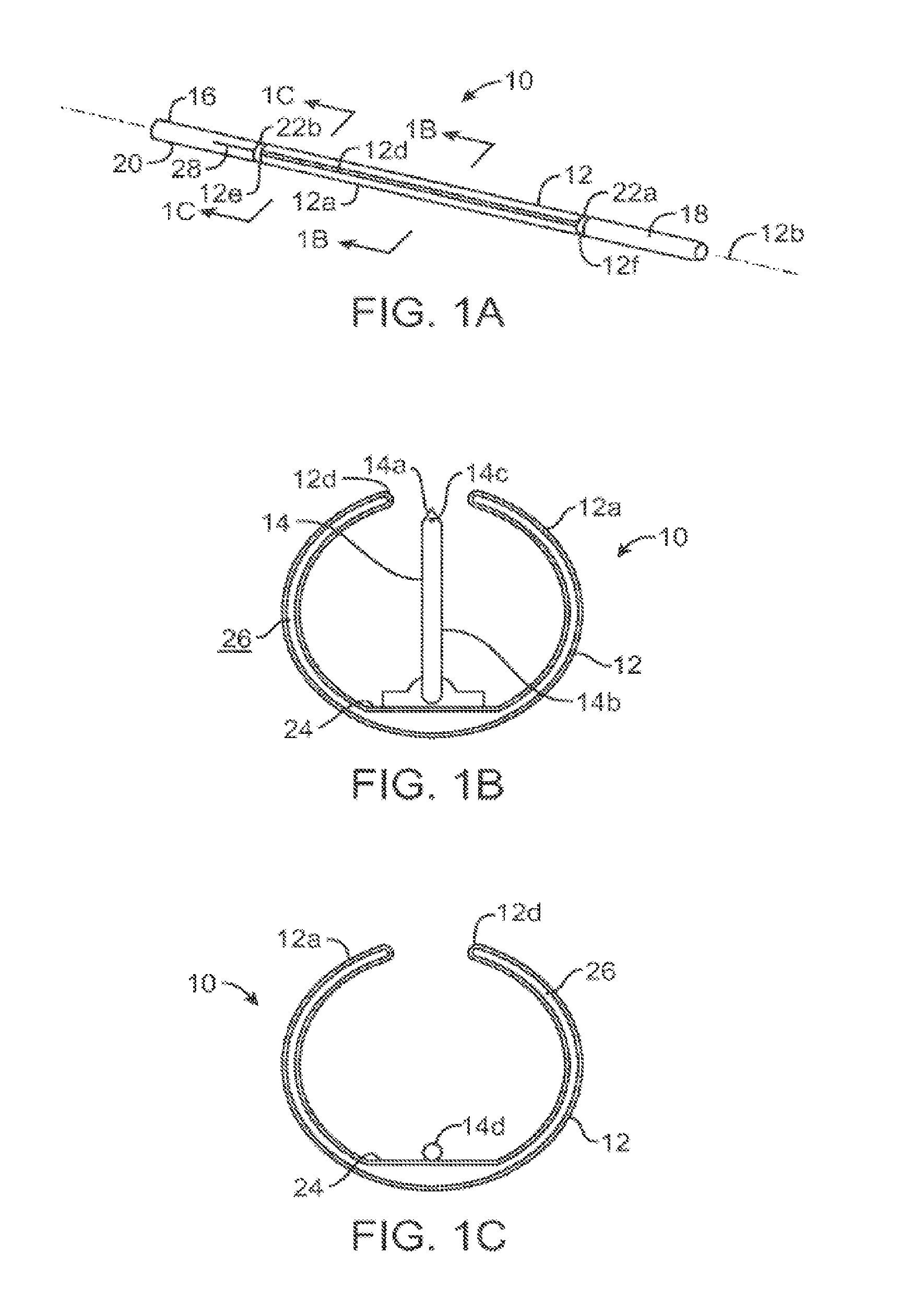 Systems and methods of treating malacia by local delivery of hydrogel to augment tissue