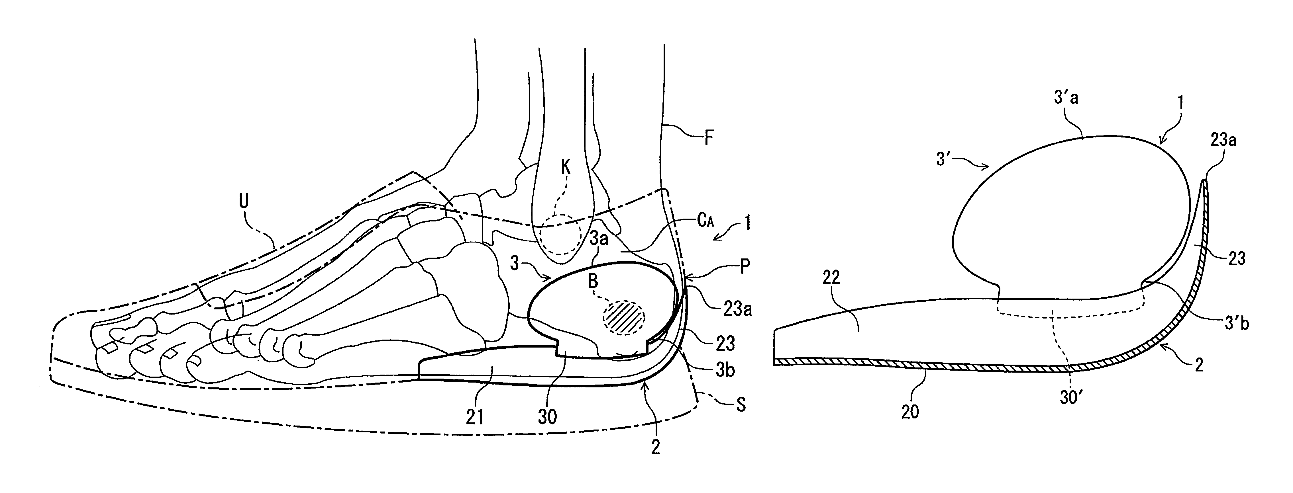 Heel counter structure for a shoe