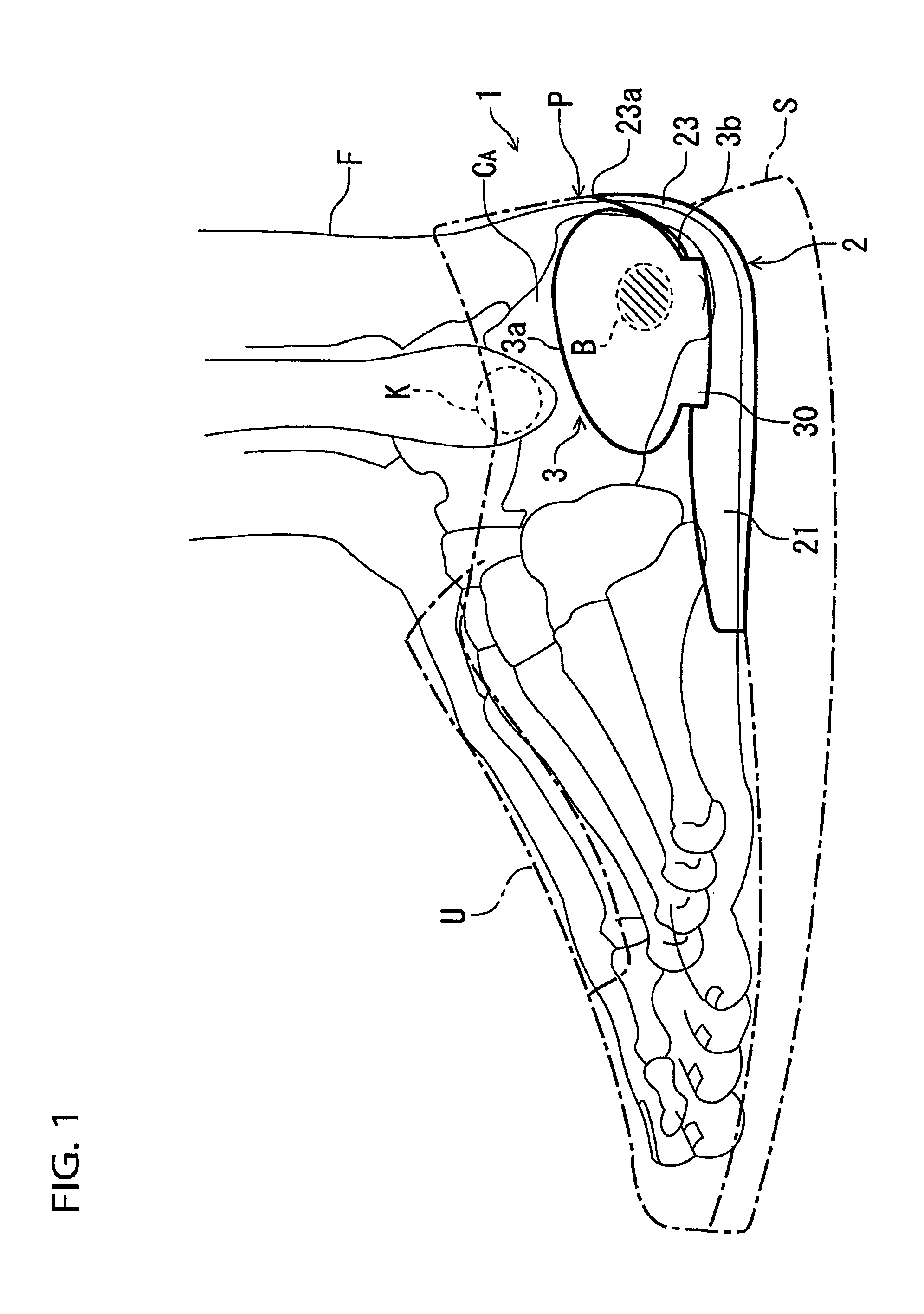 Heel counter structure for a shoe