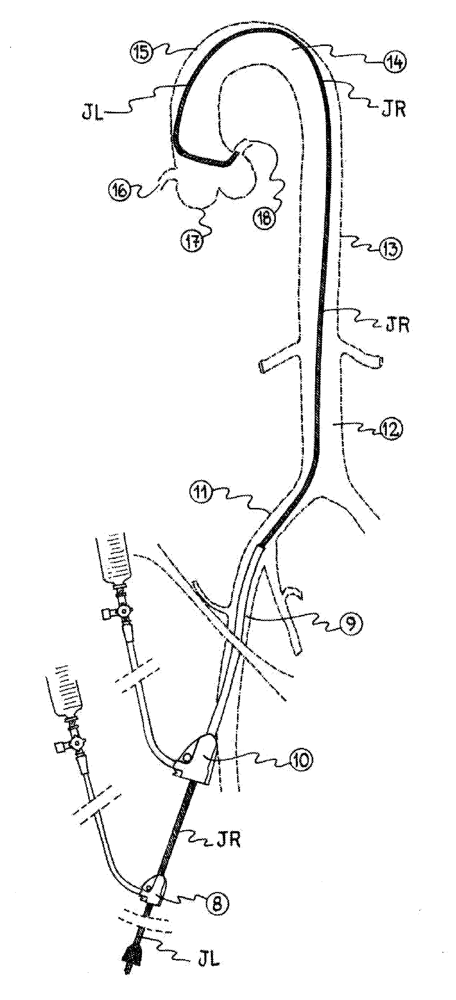 Combined catheter for angiography