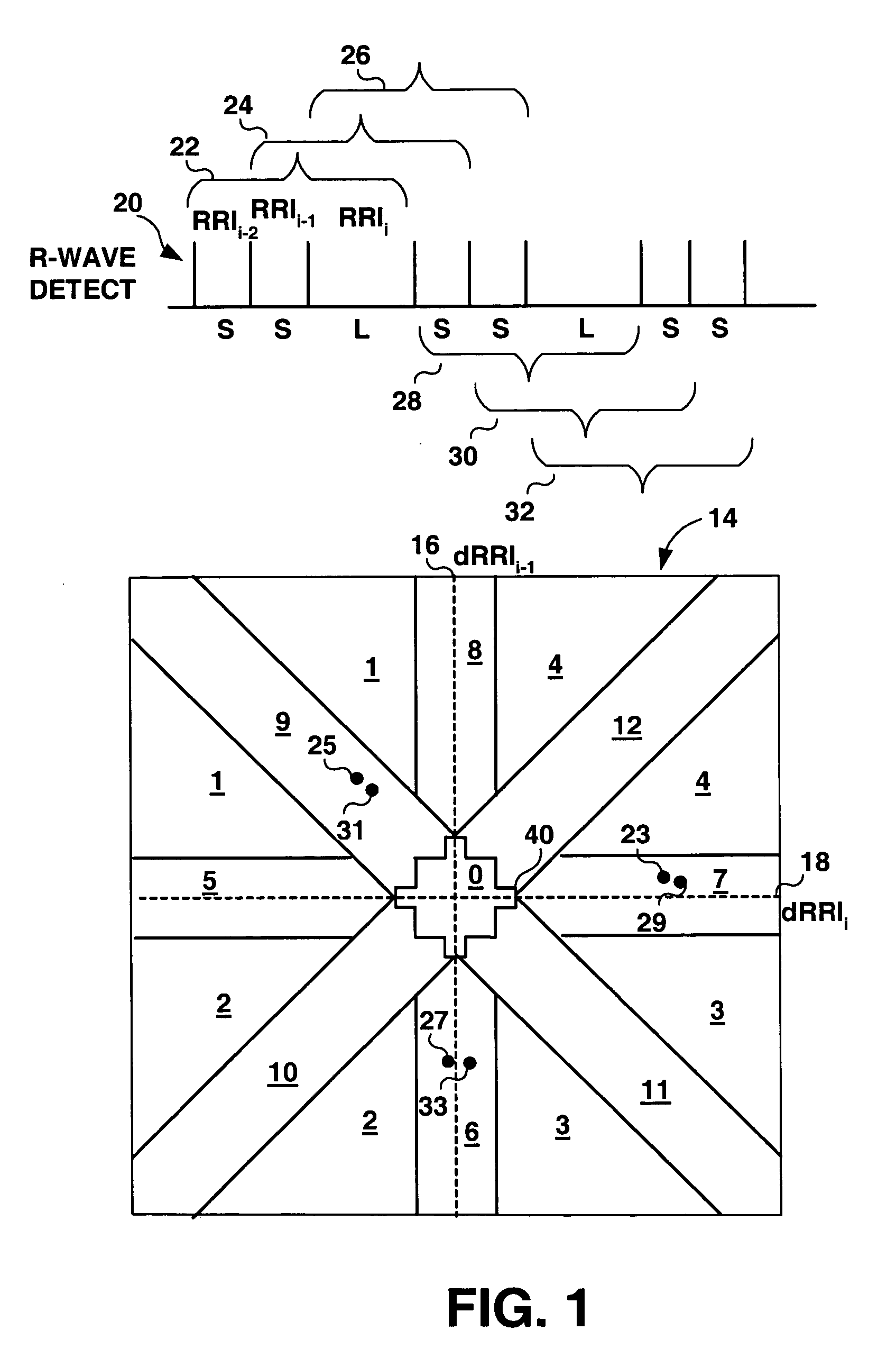 Method and apparatus for detection of tachyarrhythmia using cycle lengths