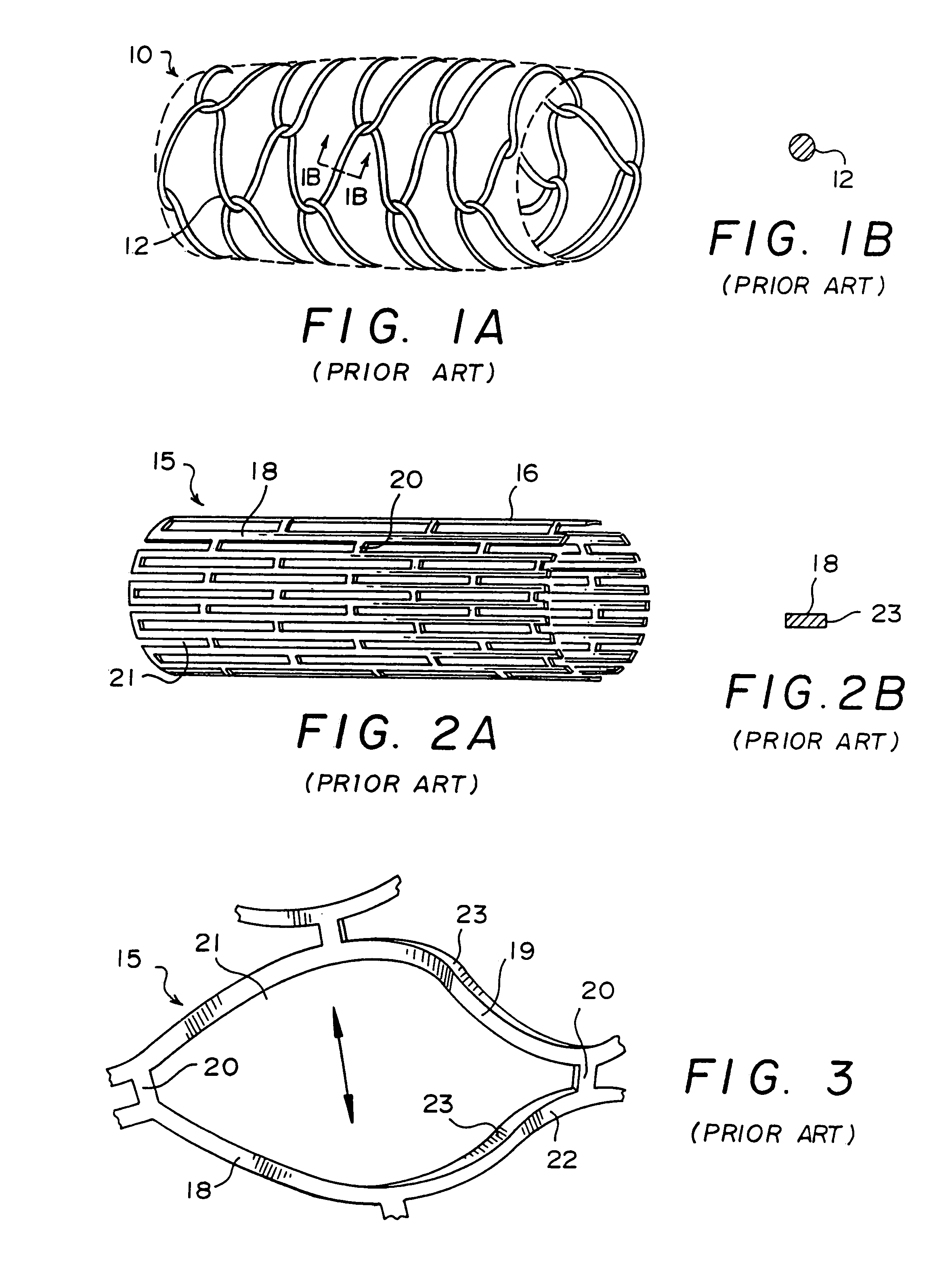 Tubular stent with oval struts