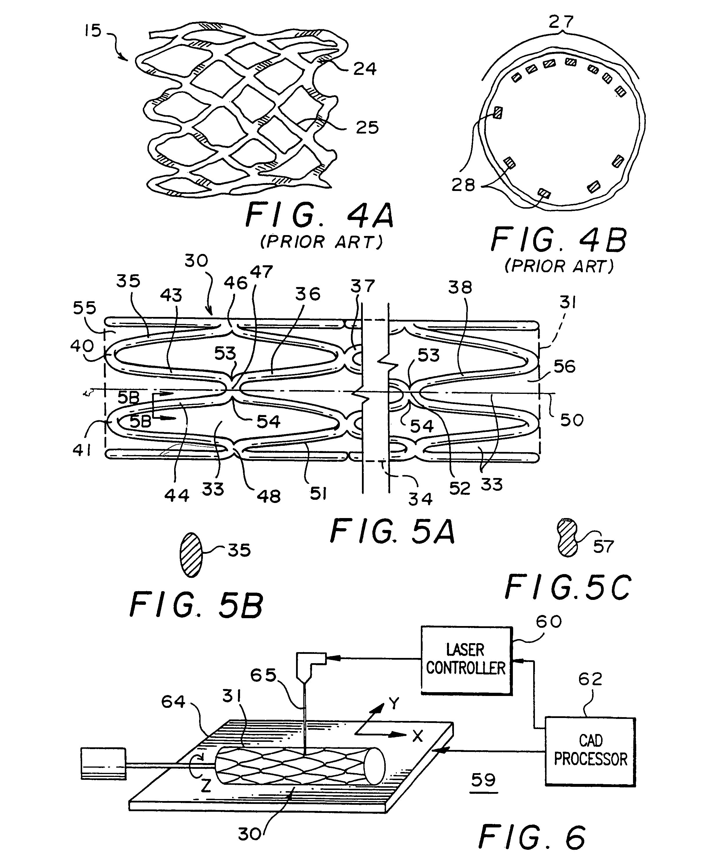 Tubular stent with oval struts