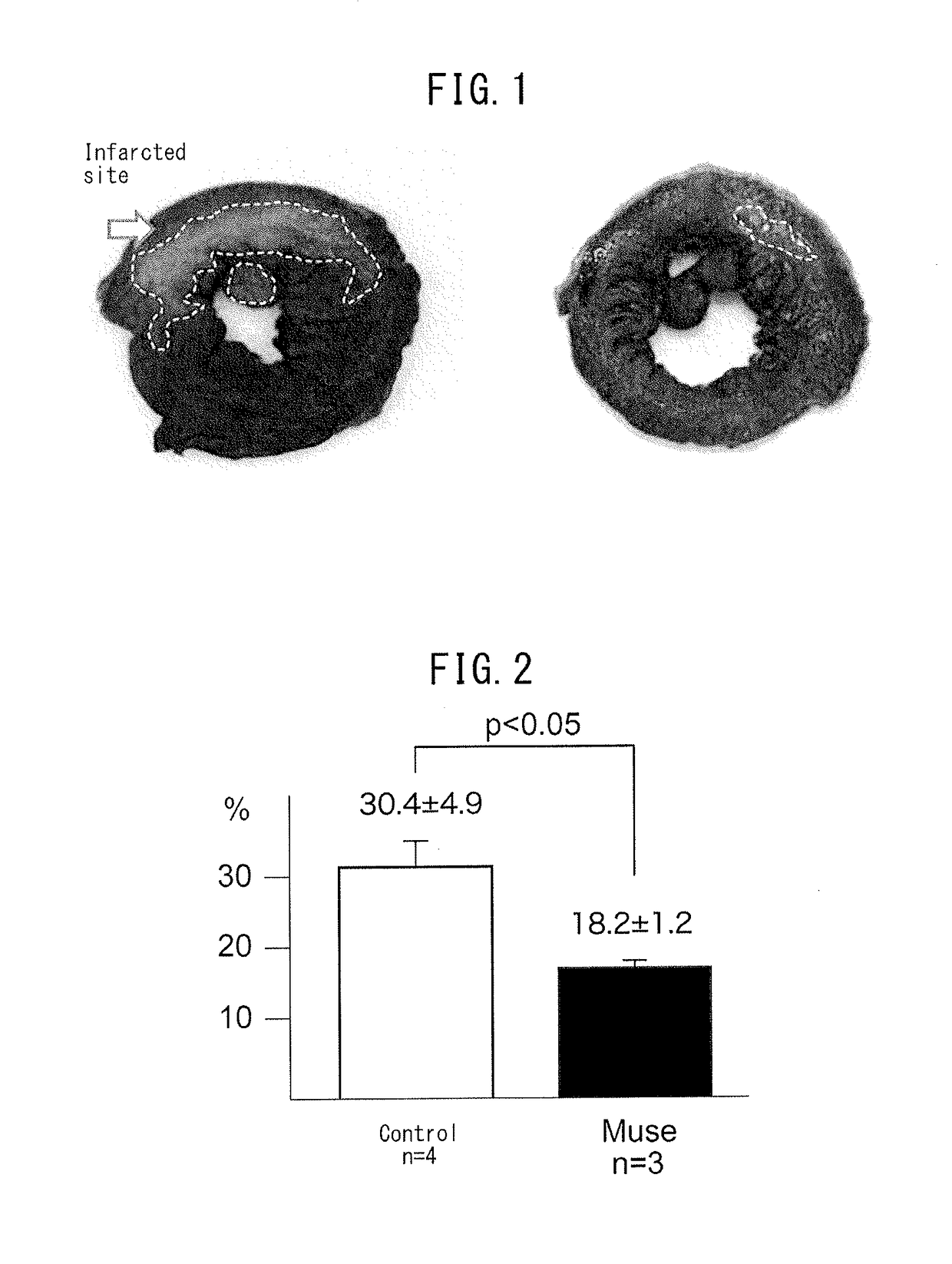 Pluripotent stem cell that induces repair and regeneration after myocardial infarction