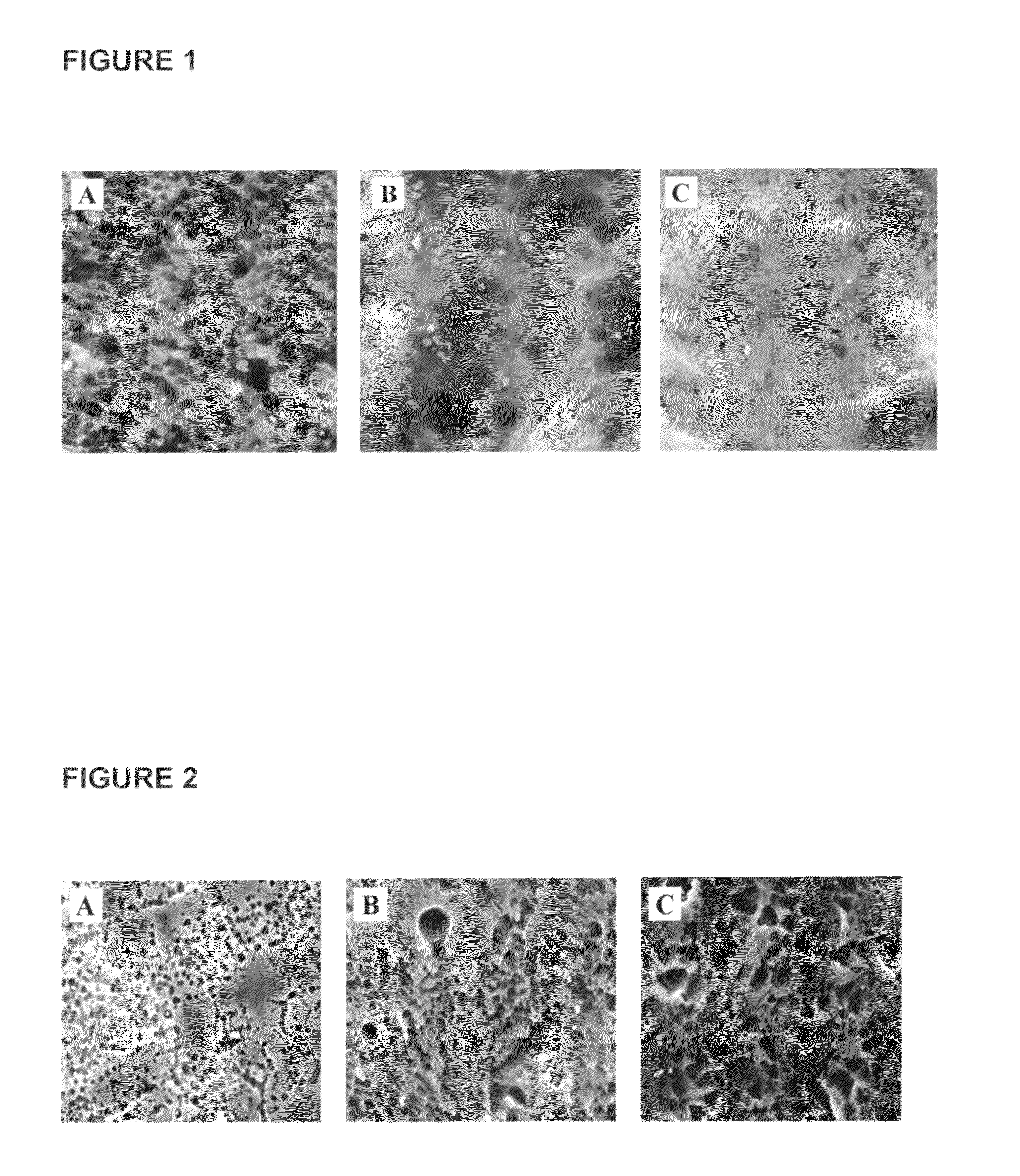 Method of surface treatment of aluminum foil and its alloy and method of producing immobilized nanocatalyst of transition metal oxides and their alloys