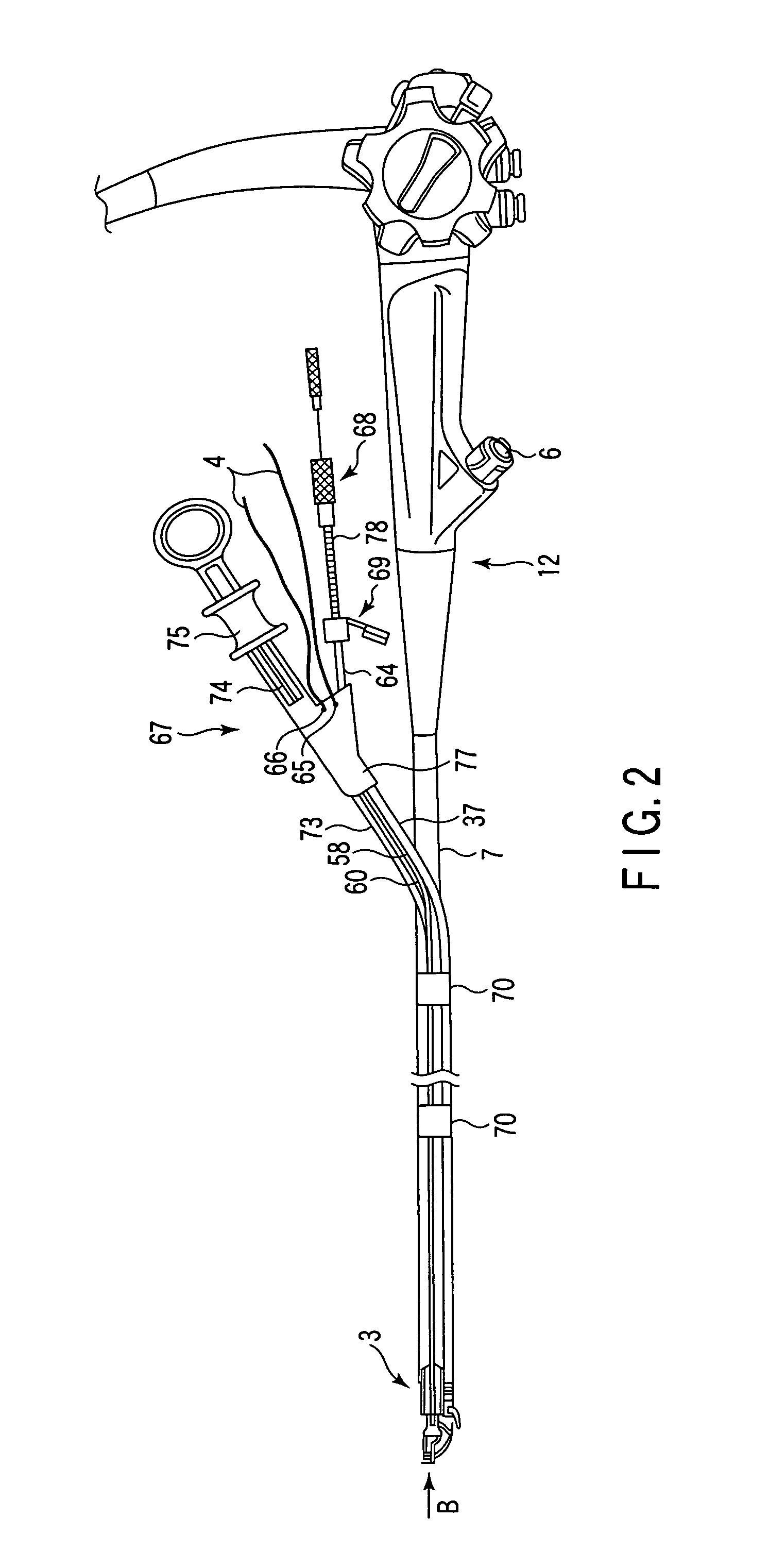 Endoscopic suturing system