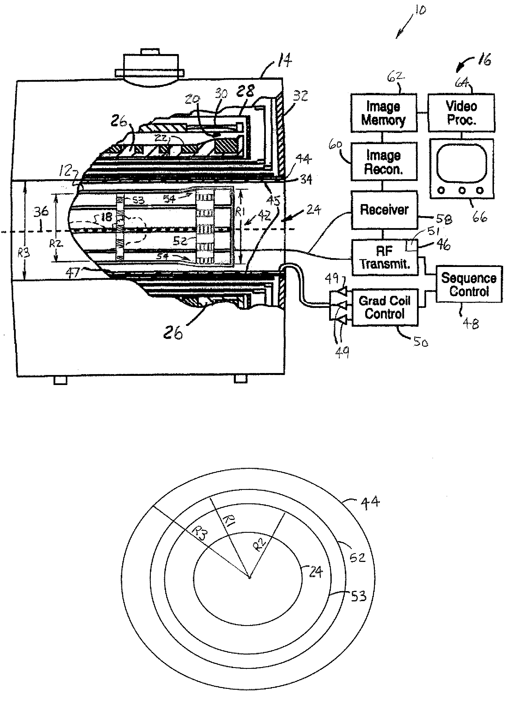 Elevated endring birdcage antenna for MRI applications