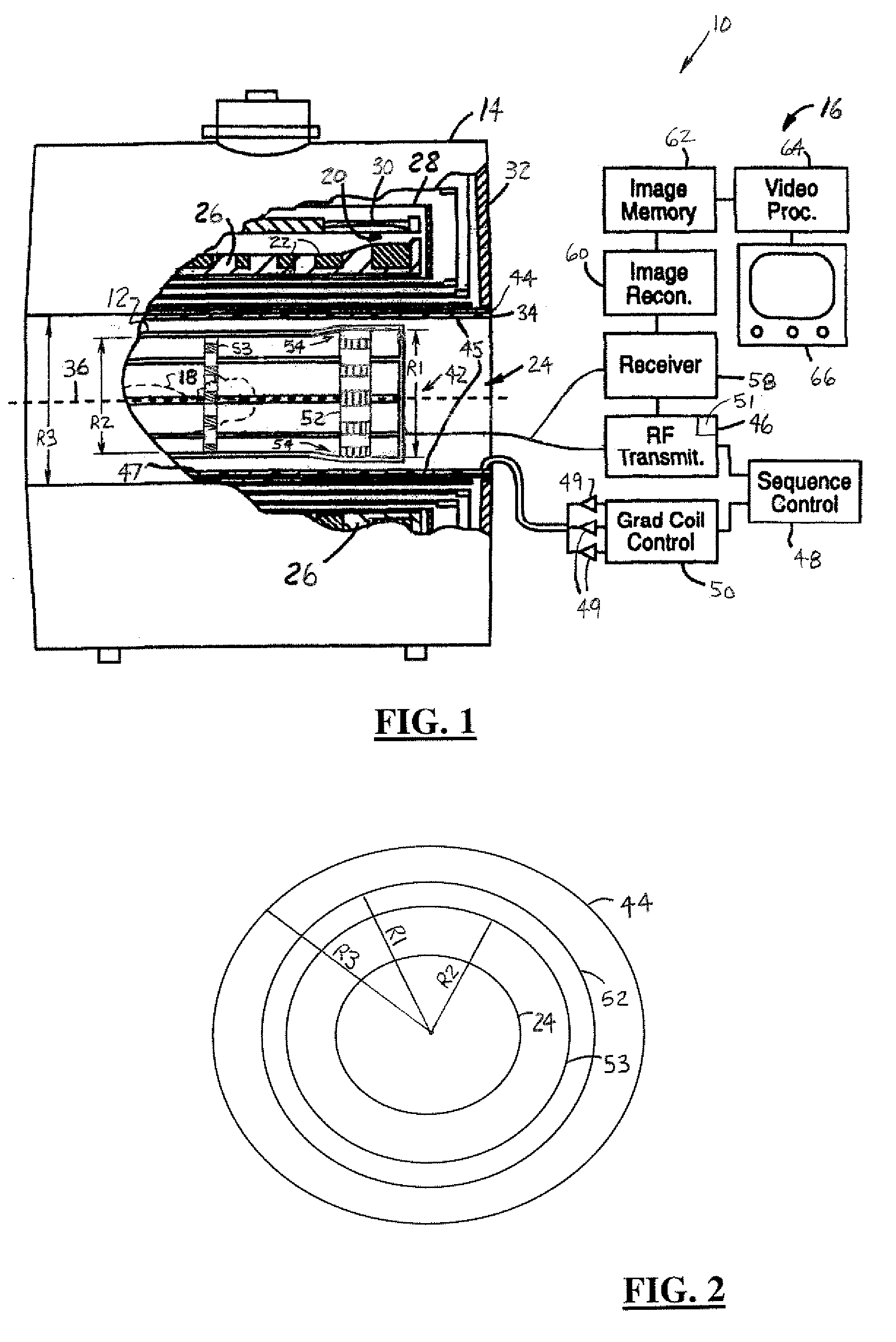 Elevated endring birdcage antenna for MRI applications