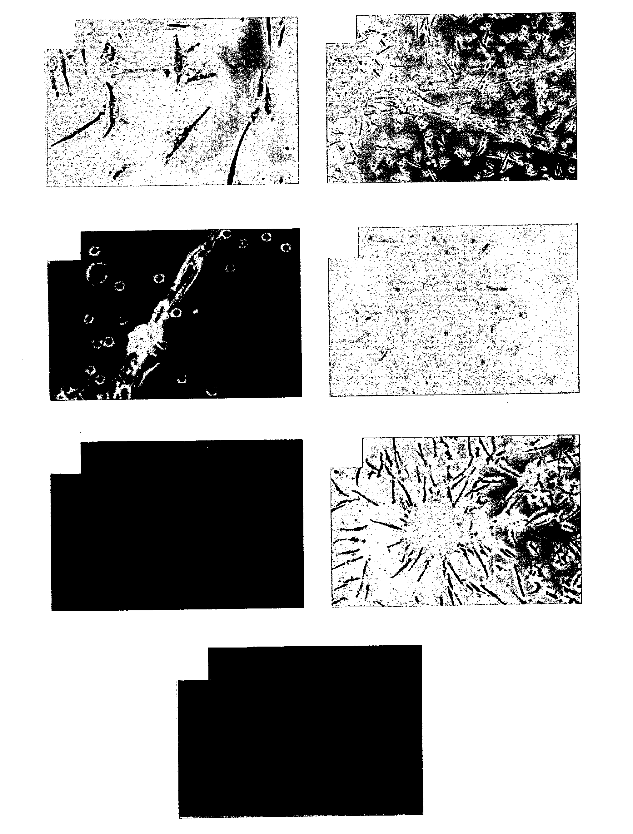 Compositions and methods for regulating angiogenesis