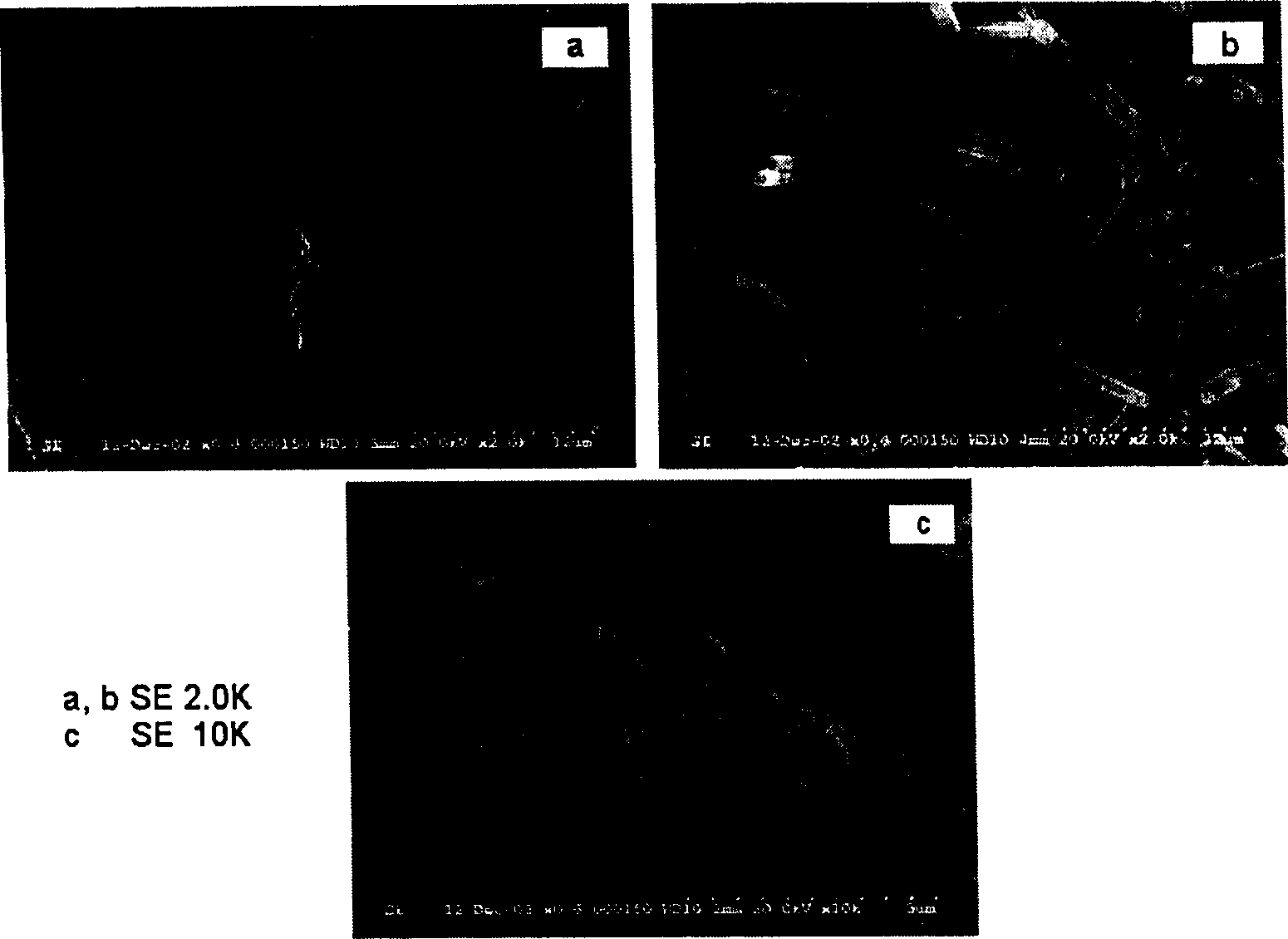 Water soluble anticancer medicine taxol composite and its prepn