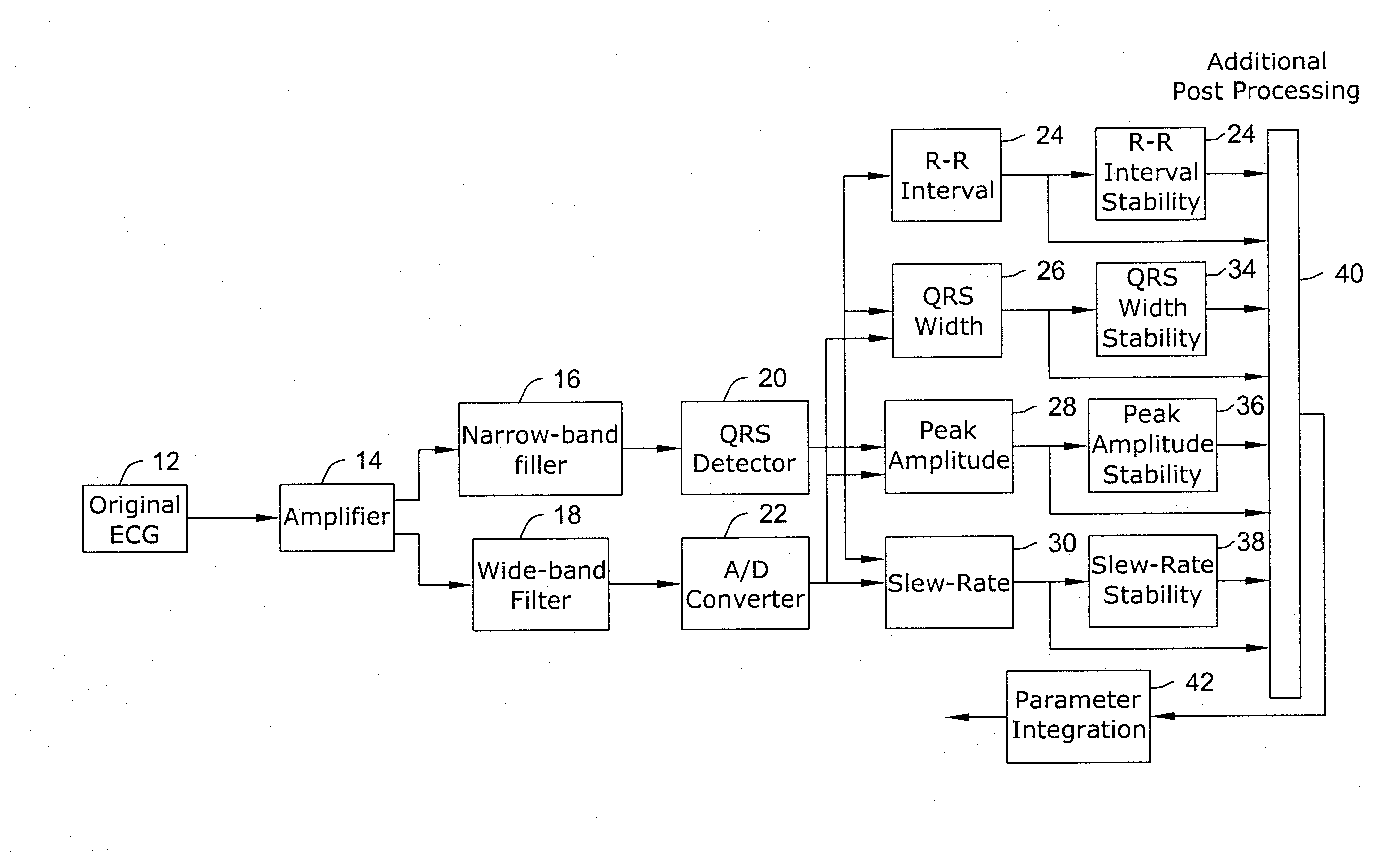 Apparatus and Method of Arrhythmia Detection in a Subcutaneous Implantable Cardioverter/Defibrillator