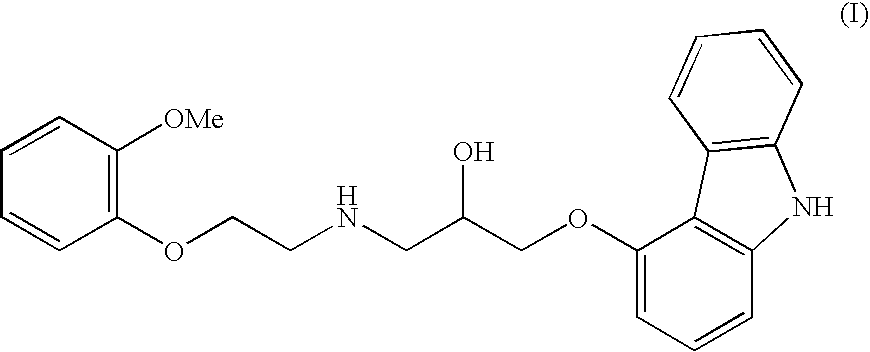 Process for preparation of carvedilol