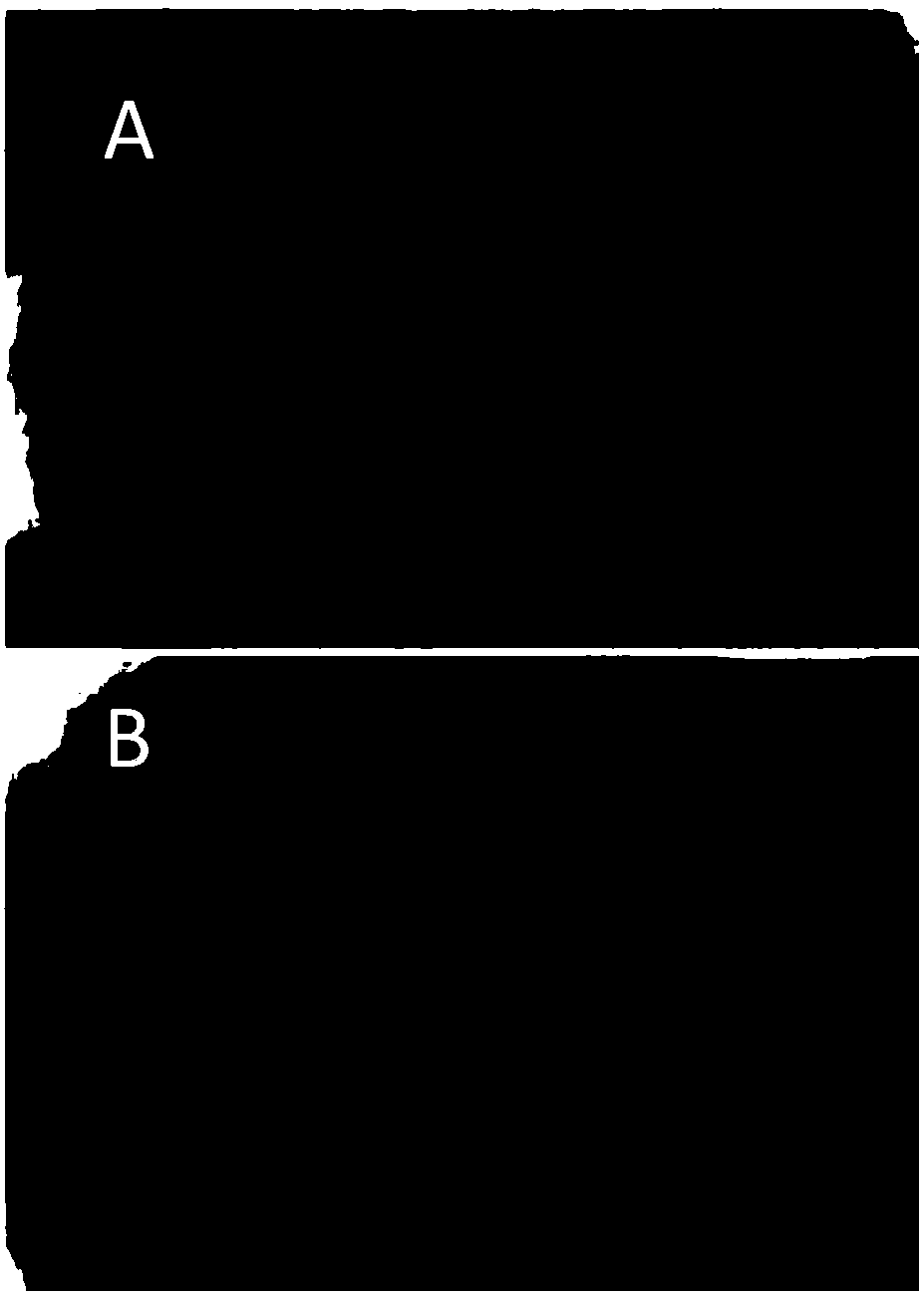 Concentrated hair-loss-preventing and hair-growth-promoting spray capable of promoting gray hair to turn black and preparation method thereof