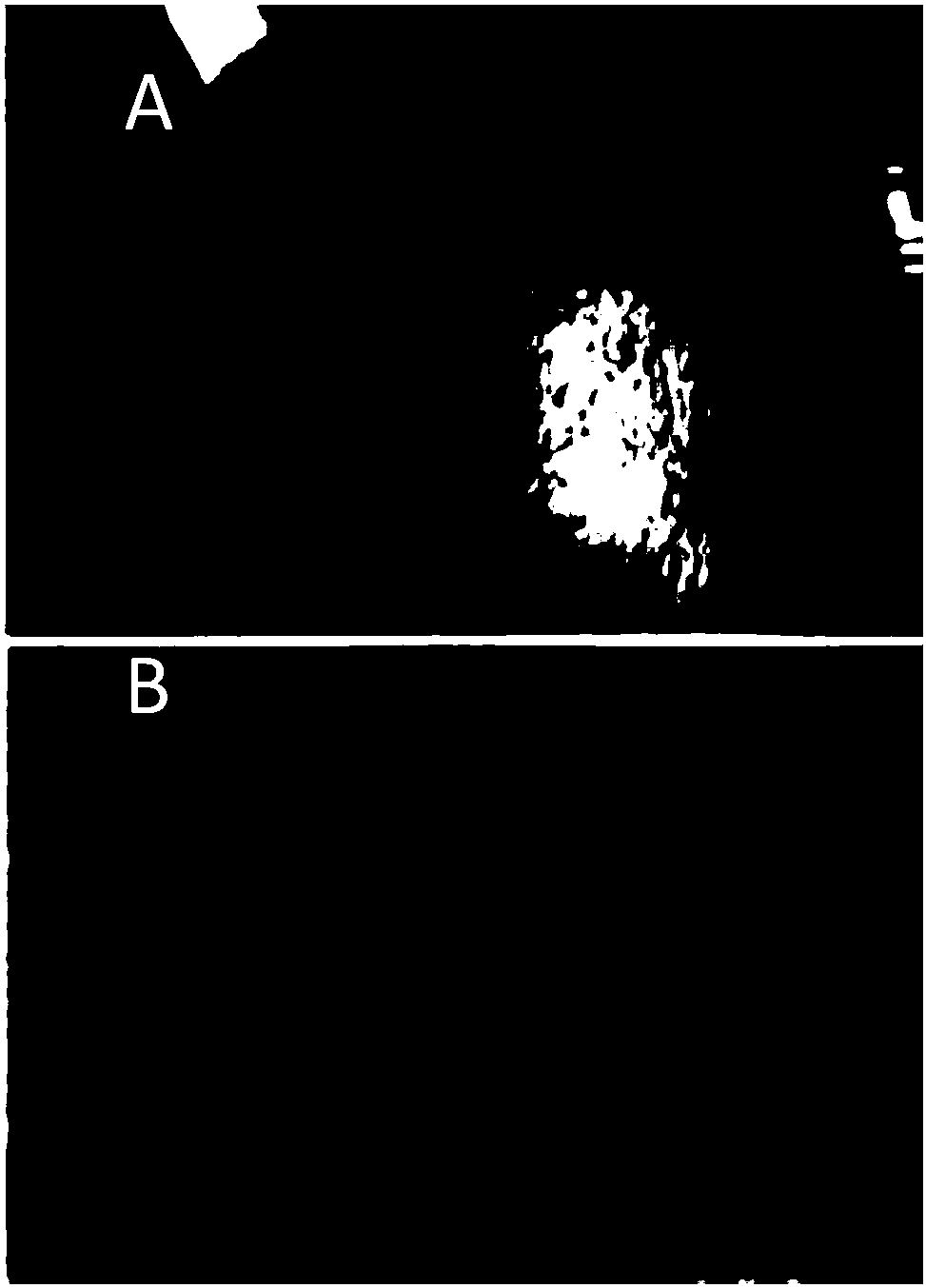 Concentrated hair-loss-preventing and hair-growth-promoting spray capable of promoting gray hair to turn black and preparation method thereof