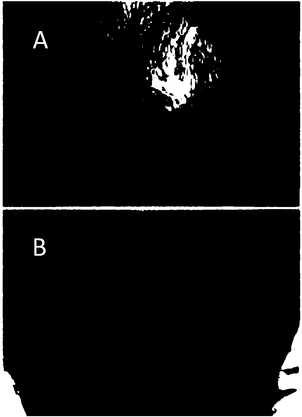 Concentrated hair-loss-preventing and hair-growth-promoting spray capable of promoting gray hair to turn black and preparation method thereof