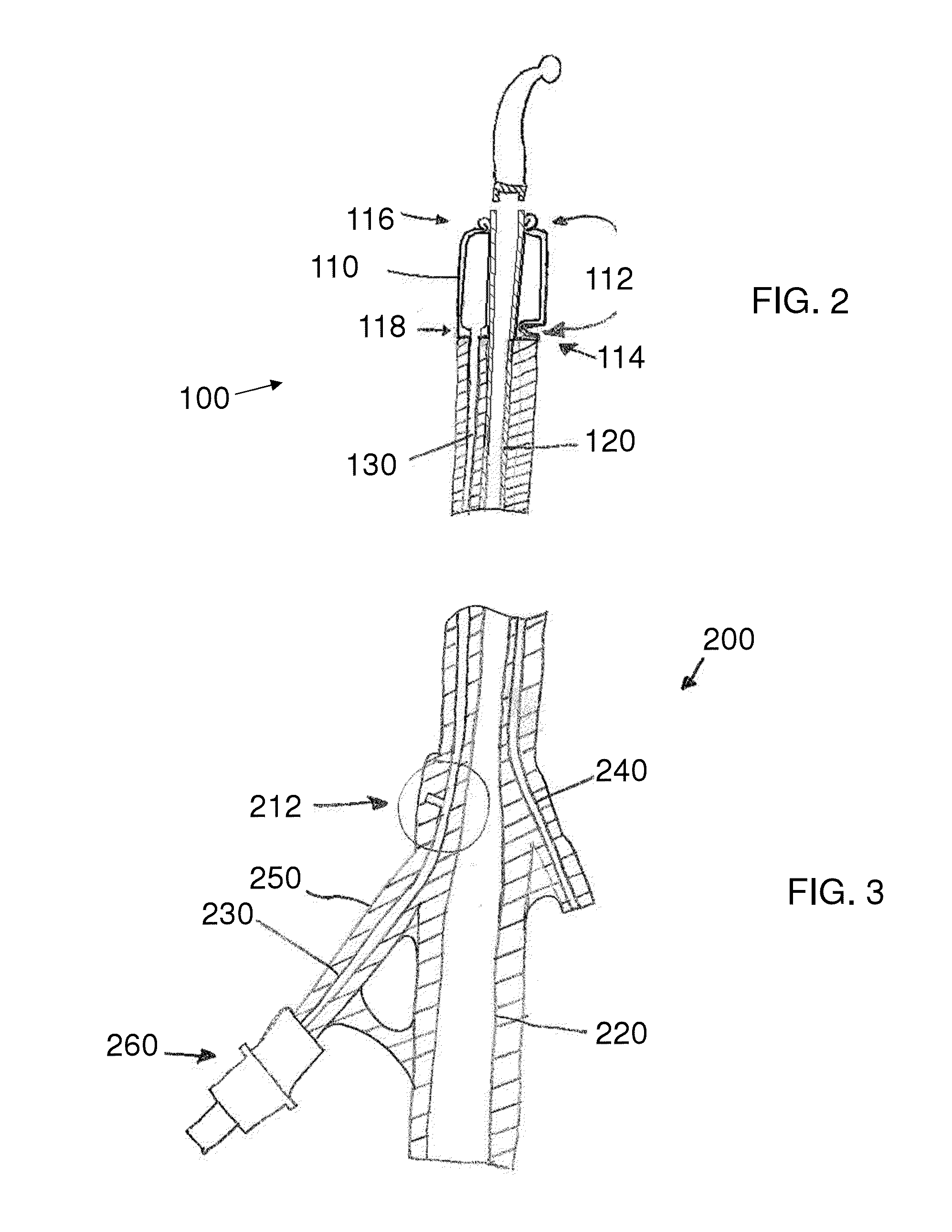 Stretch Valve Balloon Catheter and Methods for Producing and Using Same