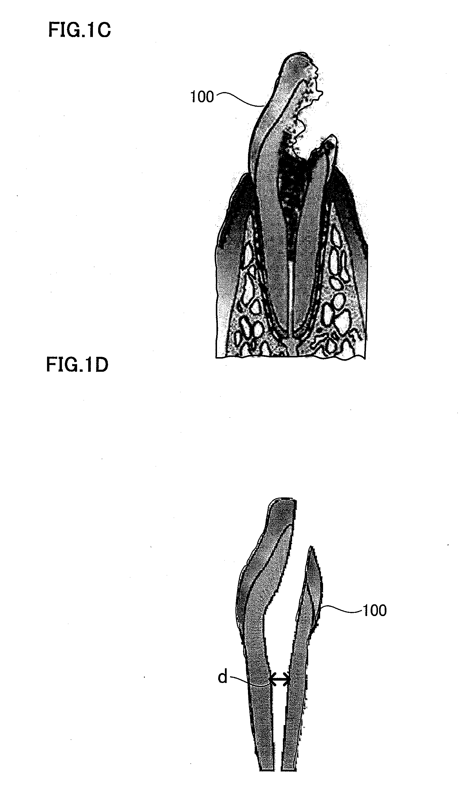 Root canal filler and dental tissue regeneration method