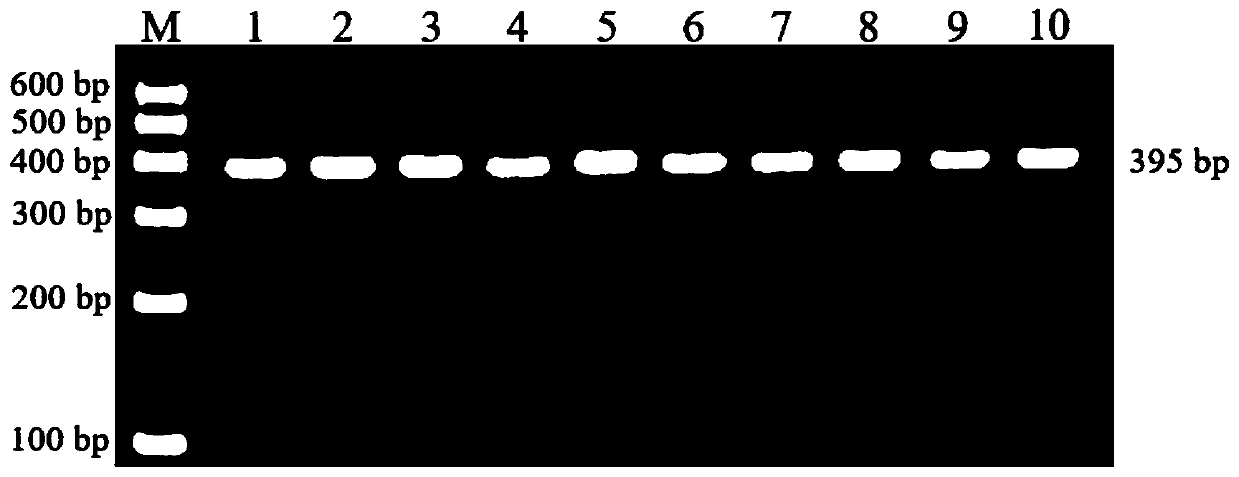 SNP molecular marker for CFL1 gene of Qinchuan cattle and detection method of SNP molecular marker