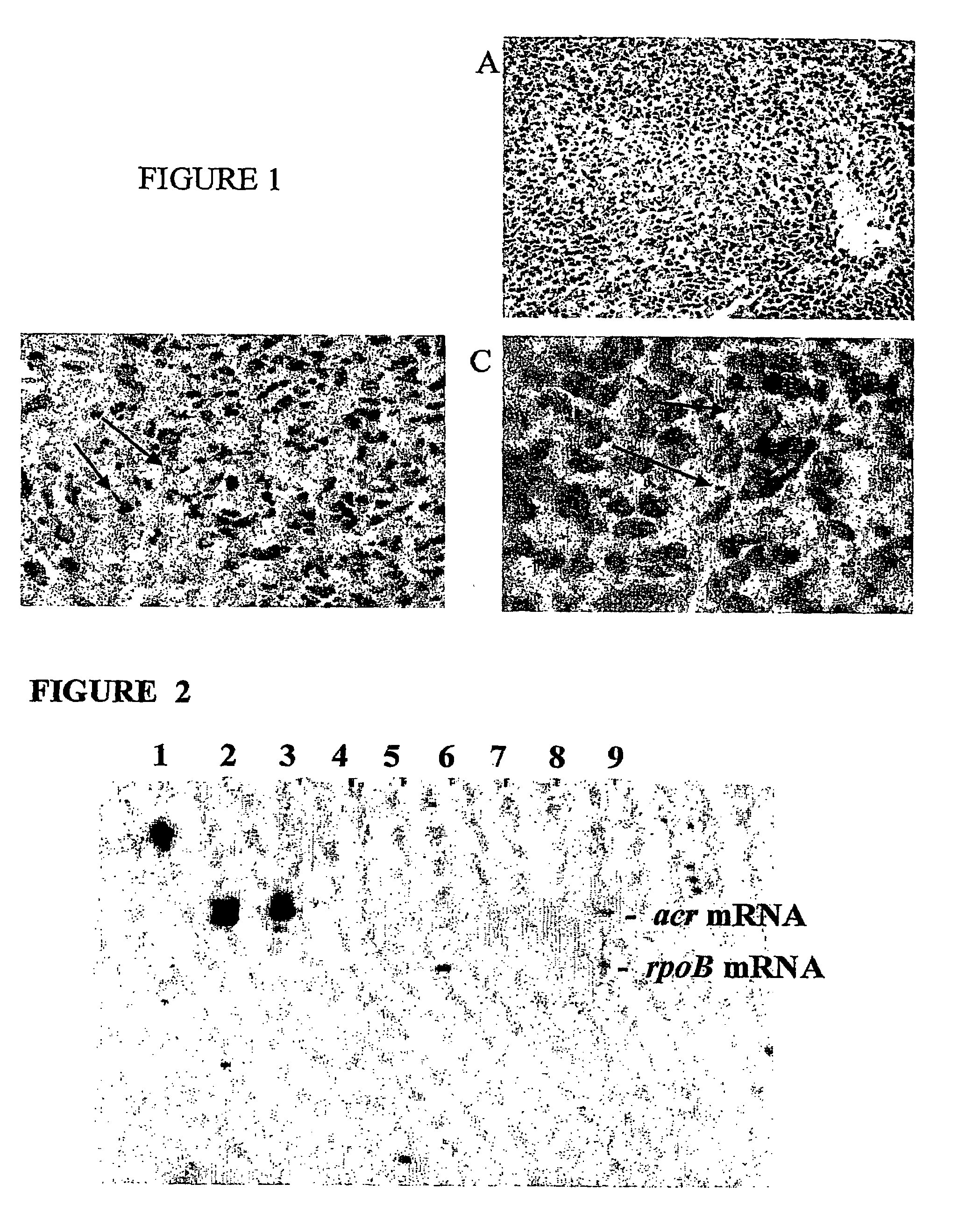 Latent human tuberculosis model, diagnostic antigens, and methods of use