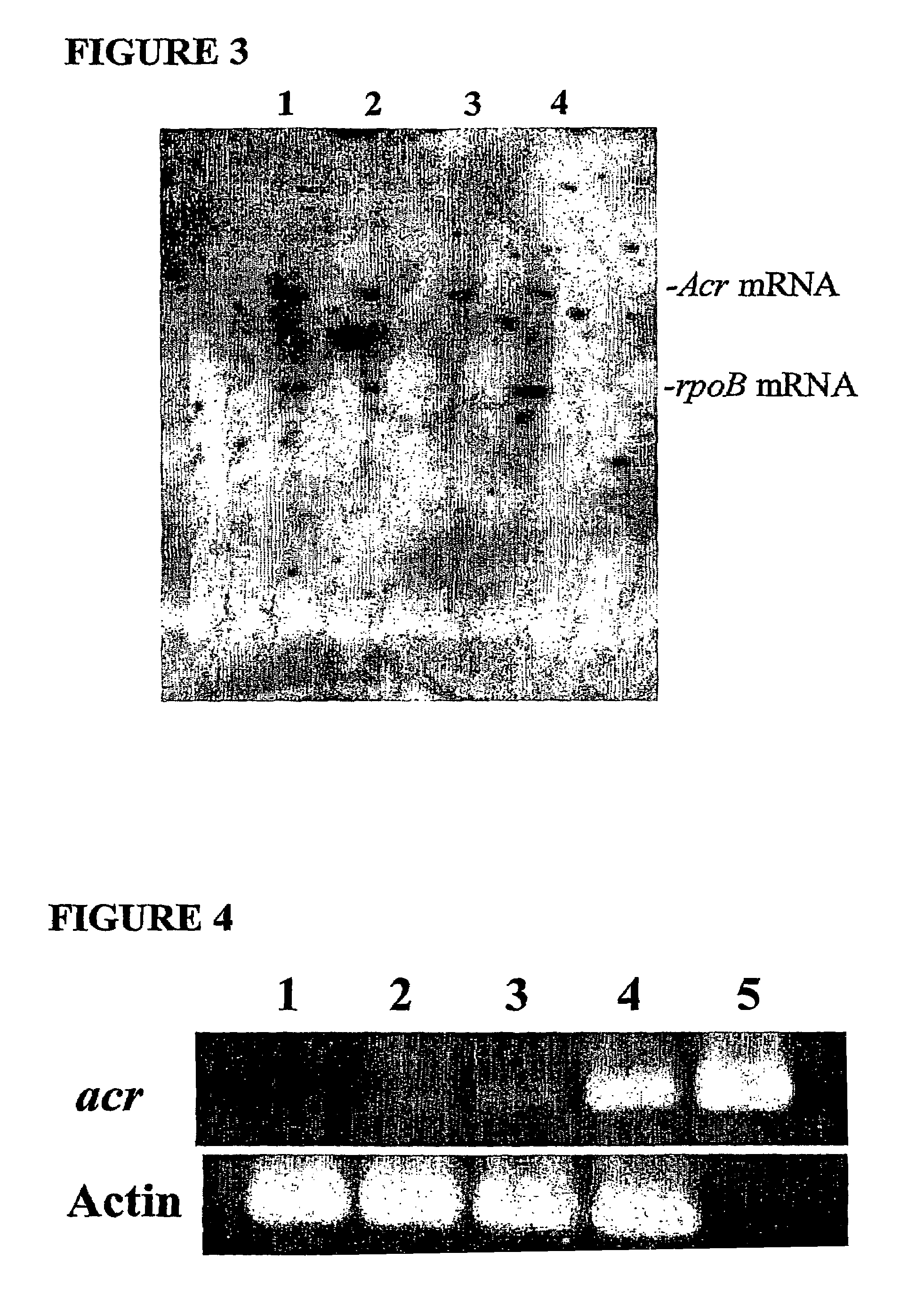 Latent human tuberculosis model, diagnostic antigens, and methods of use