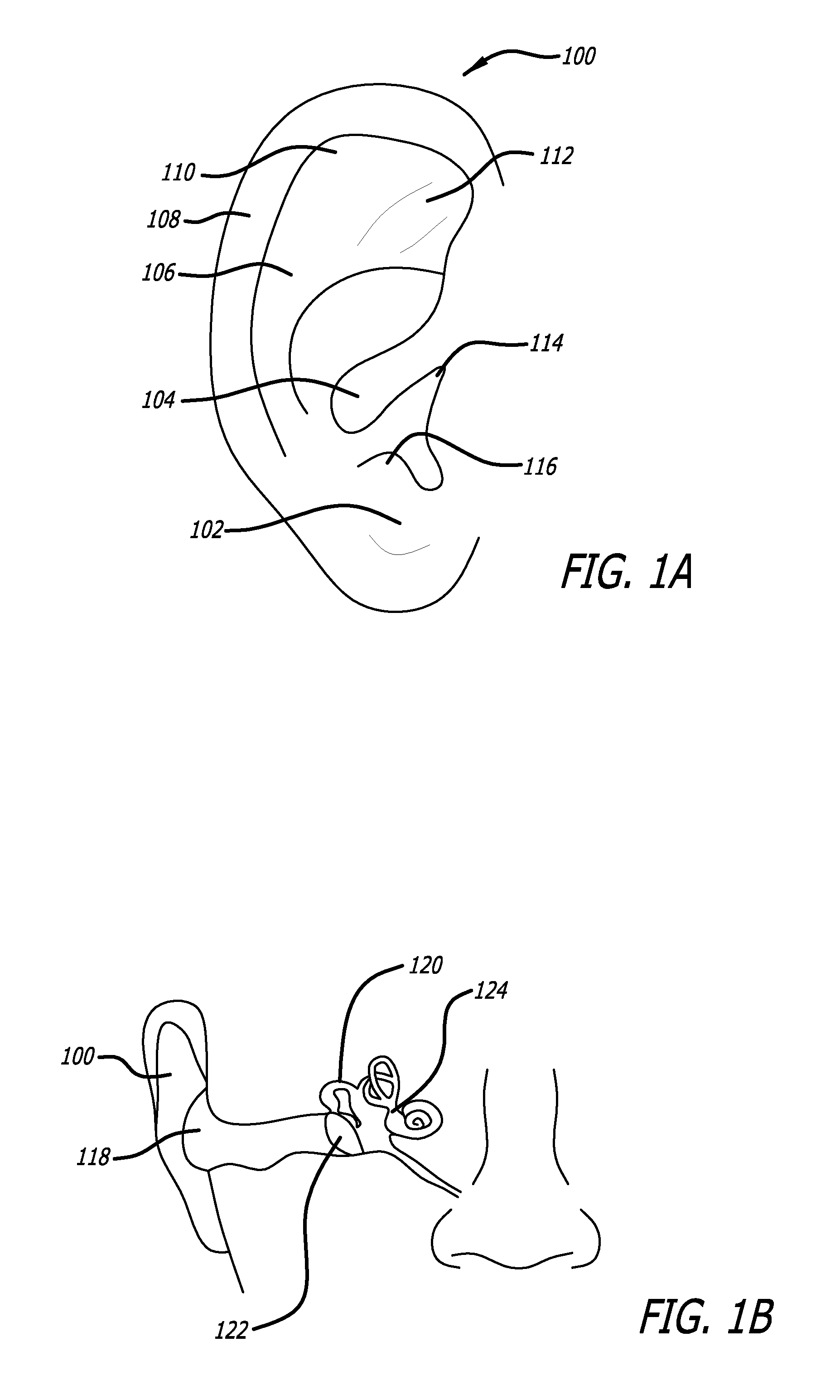 Silent effusion removal