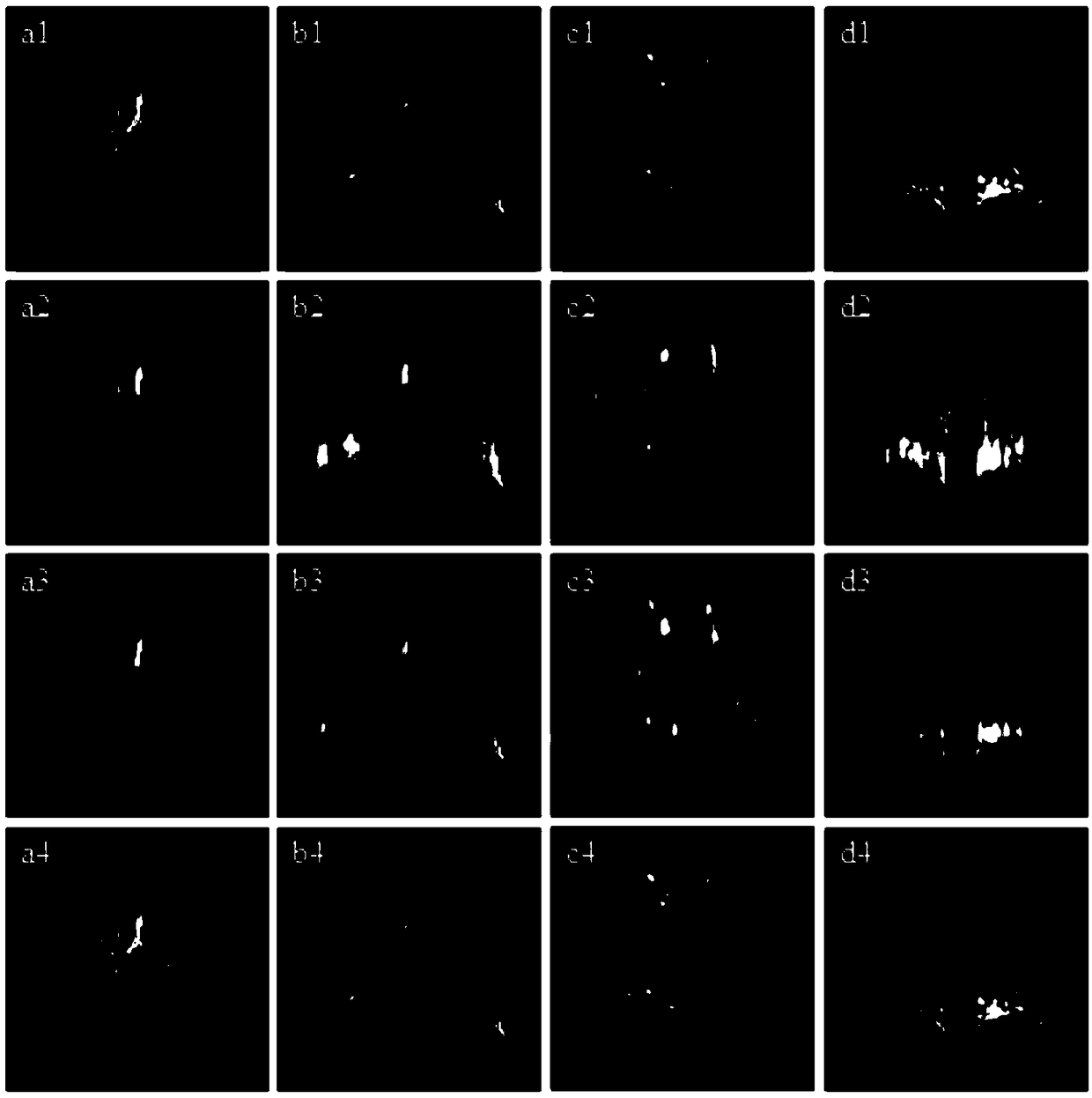 A deep learning high under-sampling hyperpolarized gas lung MRI reconstruction method