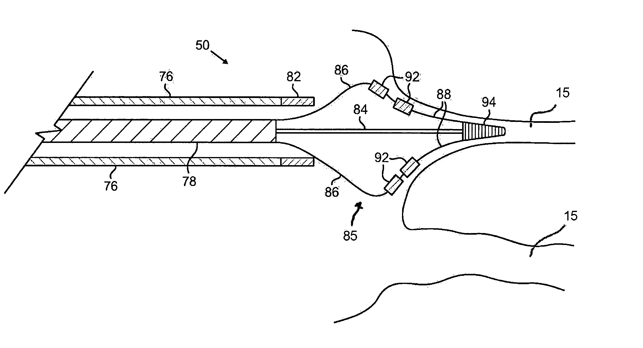 Ablation catheter