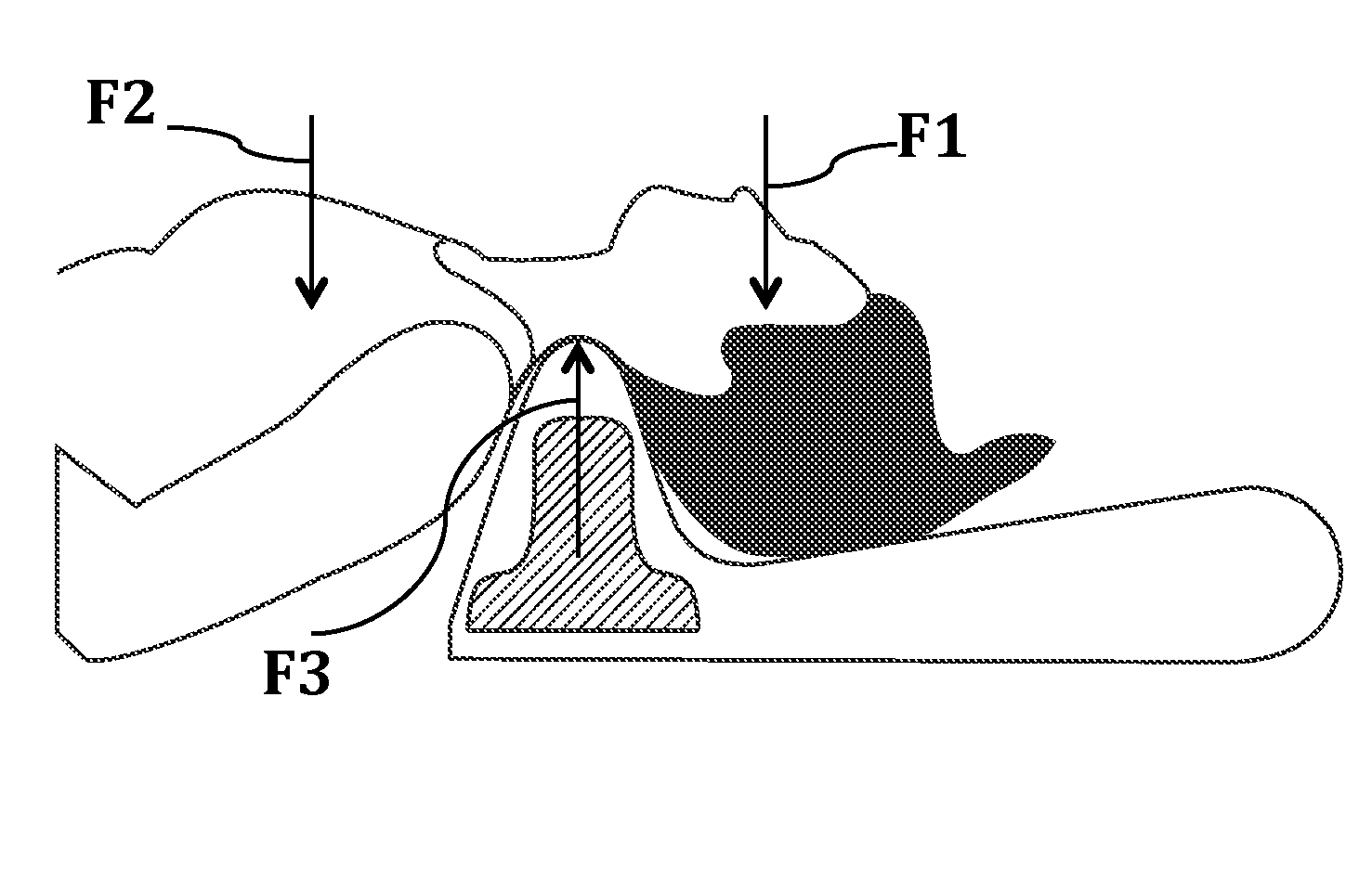 Cervical pillow for treatment of cervical spine diseases