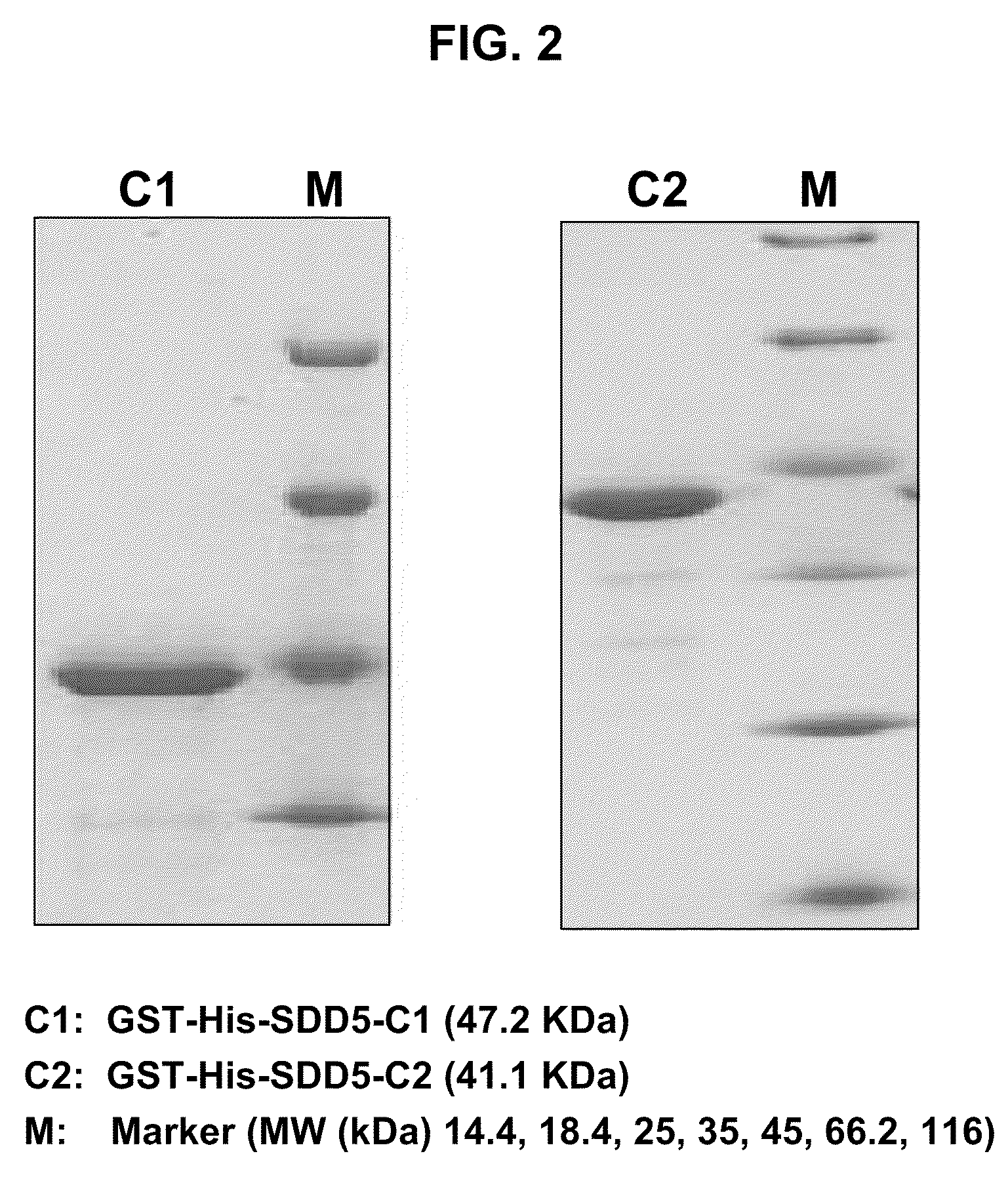 Antibodies against delta-5 desaturase and uses thereof