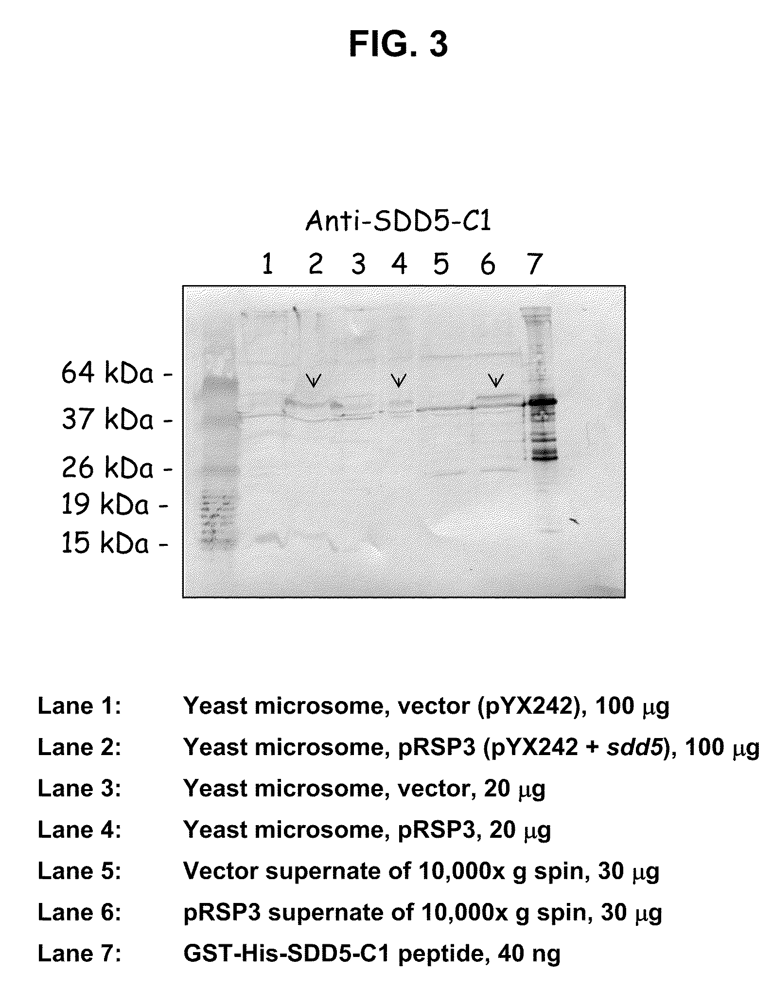 Antibodies against delta-5 desaturase and uses thereof