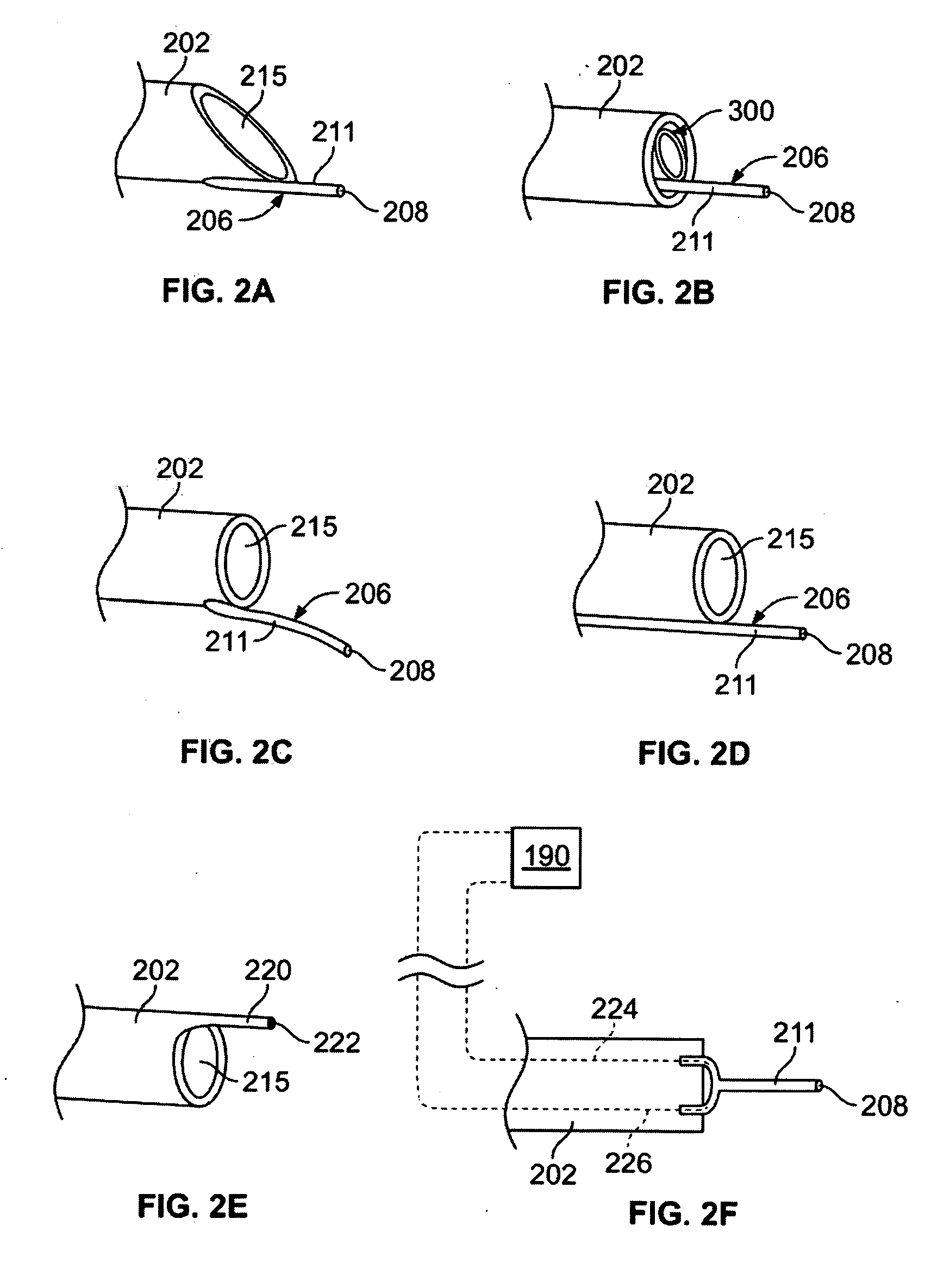 Blood vessel sensing catheter having working lumen for medical appliances