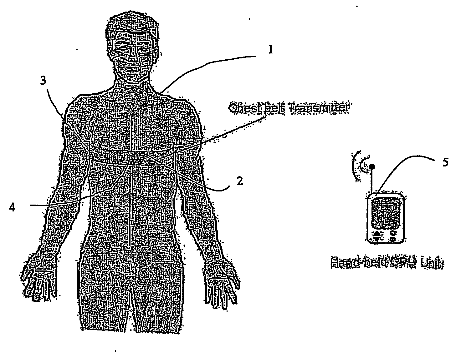 Patient monitor